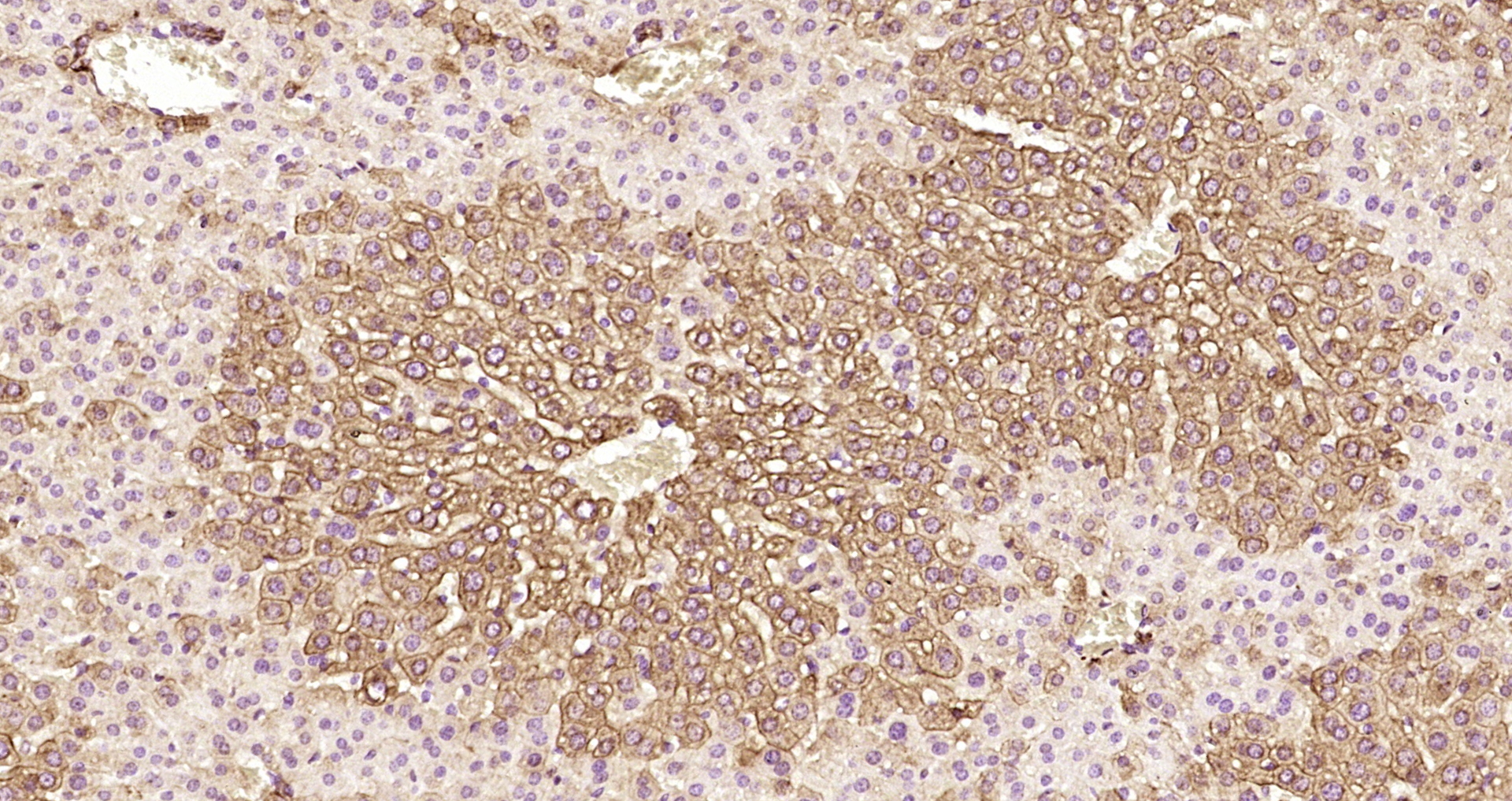 Paraformaldehyde-fixed, paraffin embedded Mouse liver; Antigen retrieval by boiling in sodium citrate buffer (pH6.0) for 15min; Block endogenous peroxidase by 3% hydrogen peroxide for 20 minutes; Blocking buffer (normal goat serum) at 37°C for 30min; Antibody incubation with KLST Polyclonal Antibody, Unconjugated (bs-5786R) at 1:200 overnight at 4°C, DAB staining.