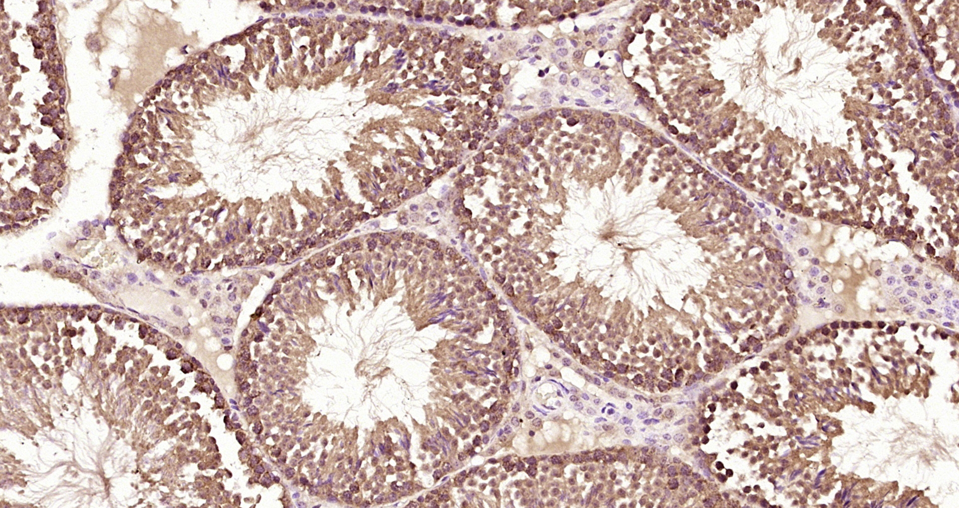 Paraformaldehyde-fixed, paraffin embedded Mouse testis; Antigen retrieval by boiling in sodium citrate buffer (pH6.0) for 15min; Block endogenous peroxidase by 3% hydrogen peroxide for 20 minutes; Blocking buffer (normal goat serum) at 37°C for 30min; Antibody incubation with RBM3 Polyclonal Antibody, Unconjugated (bs-5902R) at 1:200 overnight at 4°C, DAB staining. Paraformaldehyde-fixed, paraffin embedded Mouse testis; Antigen retrieval by boiling in sodium citrate buffer (pH6.0) for 15min; Block endogenous peroxidase by 3% hydrogen peroxide for 20 minutes; Blocking buffer (normal goat serum) at 37°C for 30min; Antibody incubation with RBM3 Polyclonal Antibody, Unconjugated (bs-5902R) at 1:200 overnight at 4°C, DAB staining.