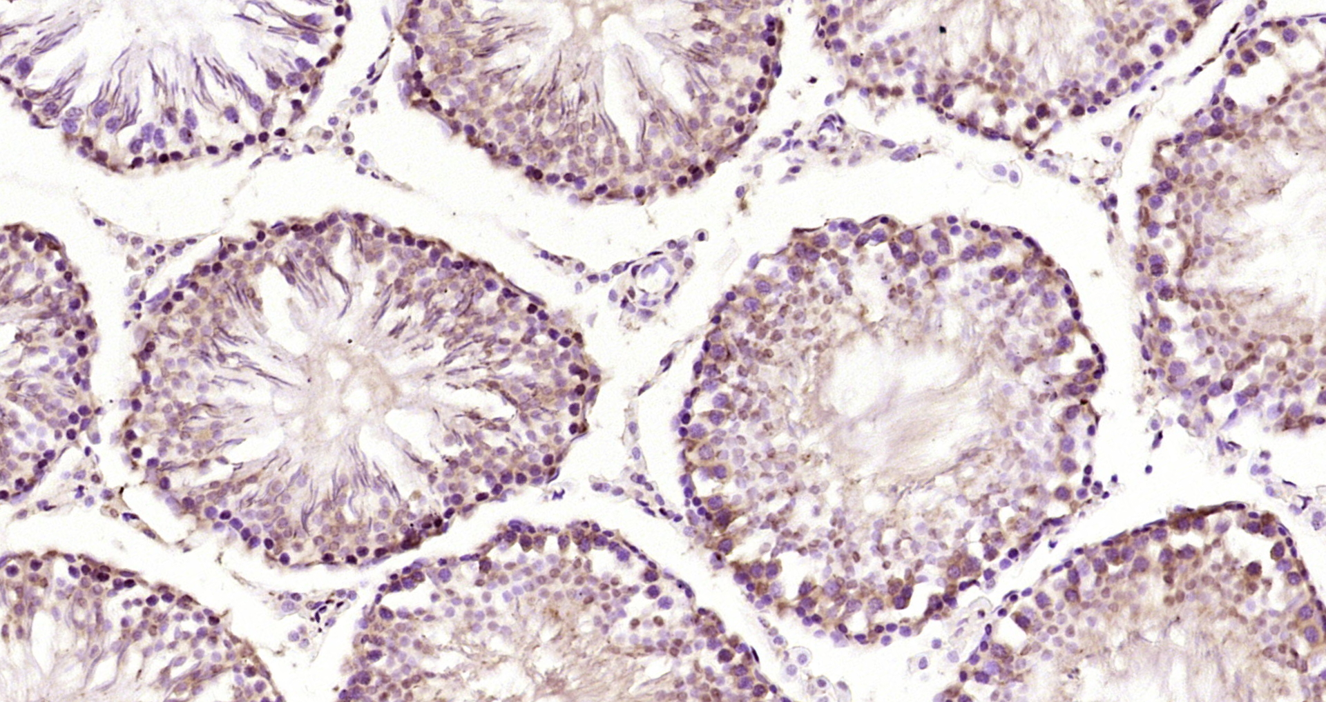 Paraformaldehyde-fixed, paraffin embedded Rat testis; Antigen retrieval by boiling in sodium citrate buffer (pH6.0) for 15min; Block endogenous peroxidase by 3% hydrogen peroxide for 20 minutes; Blocking buffer (normal goat serum) at 37°C for 30min; Antibody incubation with CDCA7L Polyclonal Antibody, Unconjugated (bs-5963R) at 1:200 overnight at 4°C, DAB staining.