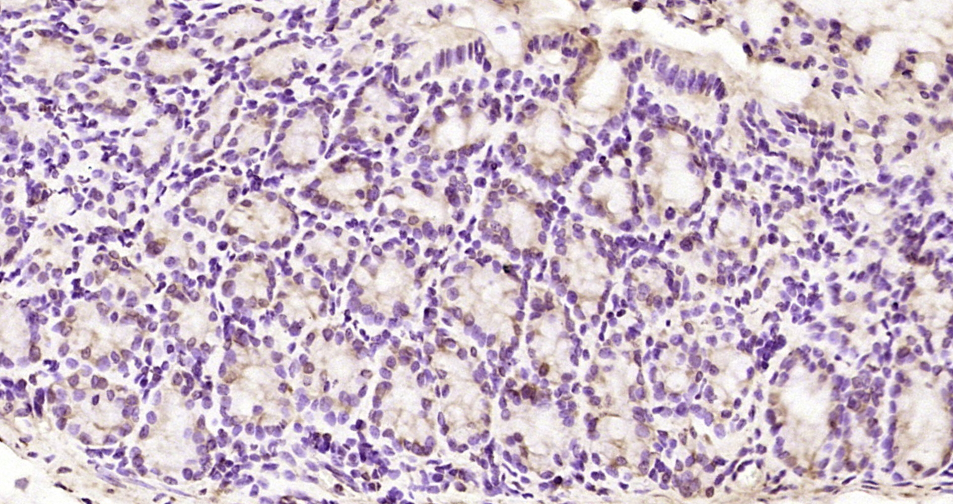 Paraformaldehyde-fixed, paraffin embedded Mouse colon; Antigen retrieval by boiling in sodium citrate buffer (pH6.0) for 15min; Block endogenous peroxidase by 3% hydrogen peroxide for 20 minutes; Blocking buffer (normal goat serum) at 37°C for 30min; Antibody incubation with CDCA7L Polyclonal Antibody, Unconjugated (bs-5963R) at 1:200 overnight at 4°C, DAB staining.