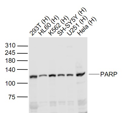 Lane 1: Human 293T cell lysates; Lane 2: Human HL-60 cell lysates; Lane 3: Human K562 cell lysates; Lane 4: Human SH-SY5Y cell lysates; Lane 5: Human U251 cell lysates; Lane 6: Human Hela cell lysates probed with PARP1 Polyclonal Antibody, Unconjugated (bs-2138R) at 1:1000 dilution and 4˚C overnight incubation. Followed by conjugated secondary antibody incubation at 1:20000 for 60 min at 37˚C.