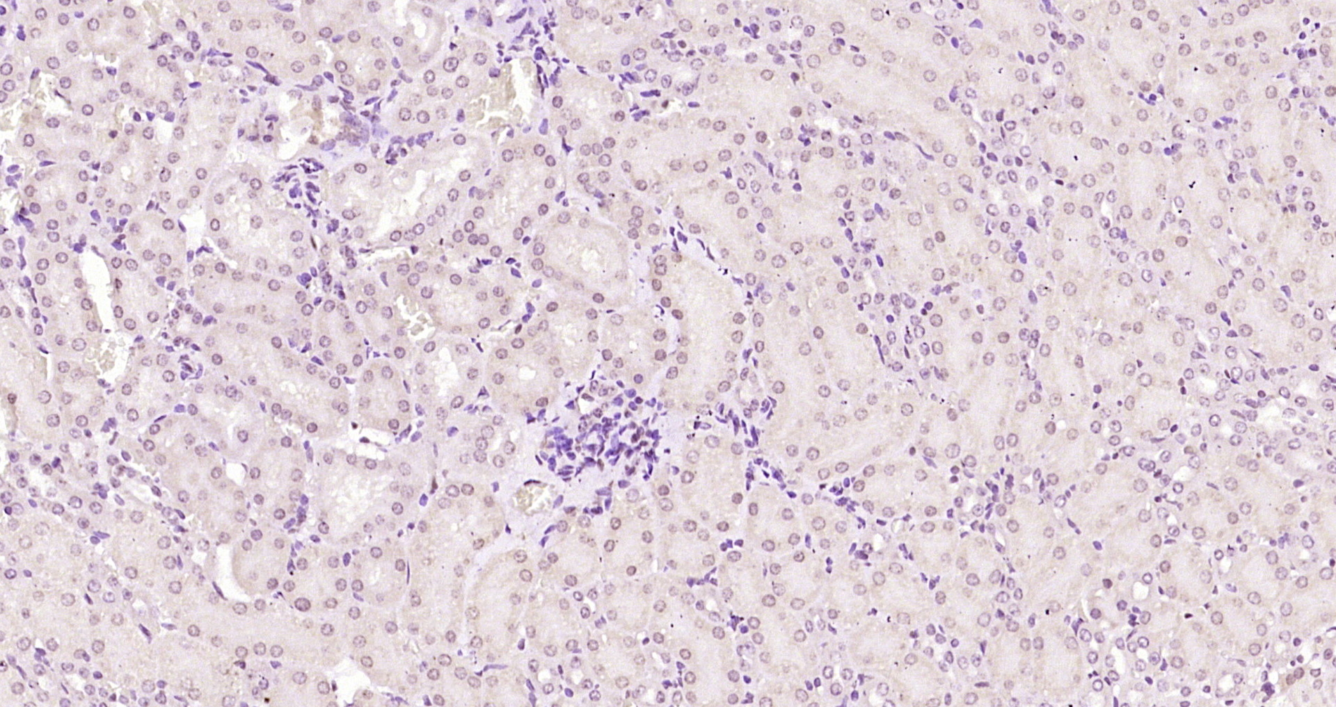 Paraformaldehyde-fixed, paraffin embedded Mouse kidney; Antigen retrieval by boiling in sodium citrate buffer (pH6.0) for 15min; Block endogenous peroxidase by 3% hydrogen peroxide for 20 minutes; Blocking buffer (normal goat serum) at 37°C for 30min; Antibody incubation with SNF5 Polyclonal Antibody, Unconjugated (bs-6109R) at 1:200 overnight at 4°C, DAB staining.