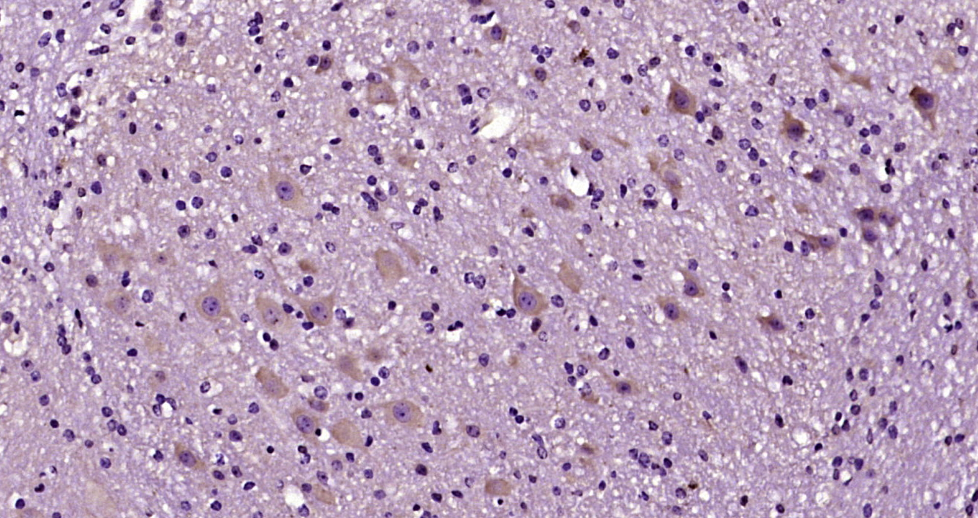 Paraformaldehyde-fixed, paraffin embedded Mouse cerebellum; Antigen retrieval by boiling in sodium citrate buffer (pH6.0) for 15min; Block endogenous peroxidase by 3% hydrogen peroxide for 20 minutes; Blocking buffer (normal goat serum) at 37°C for 30min; Antibody incubation with WNT2 Polyclonal Antibody, Unconjugated (bs-6133R) at 1:200 overnight at 4°C, DAB staining.