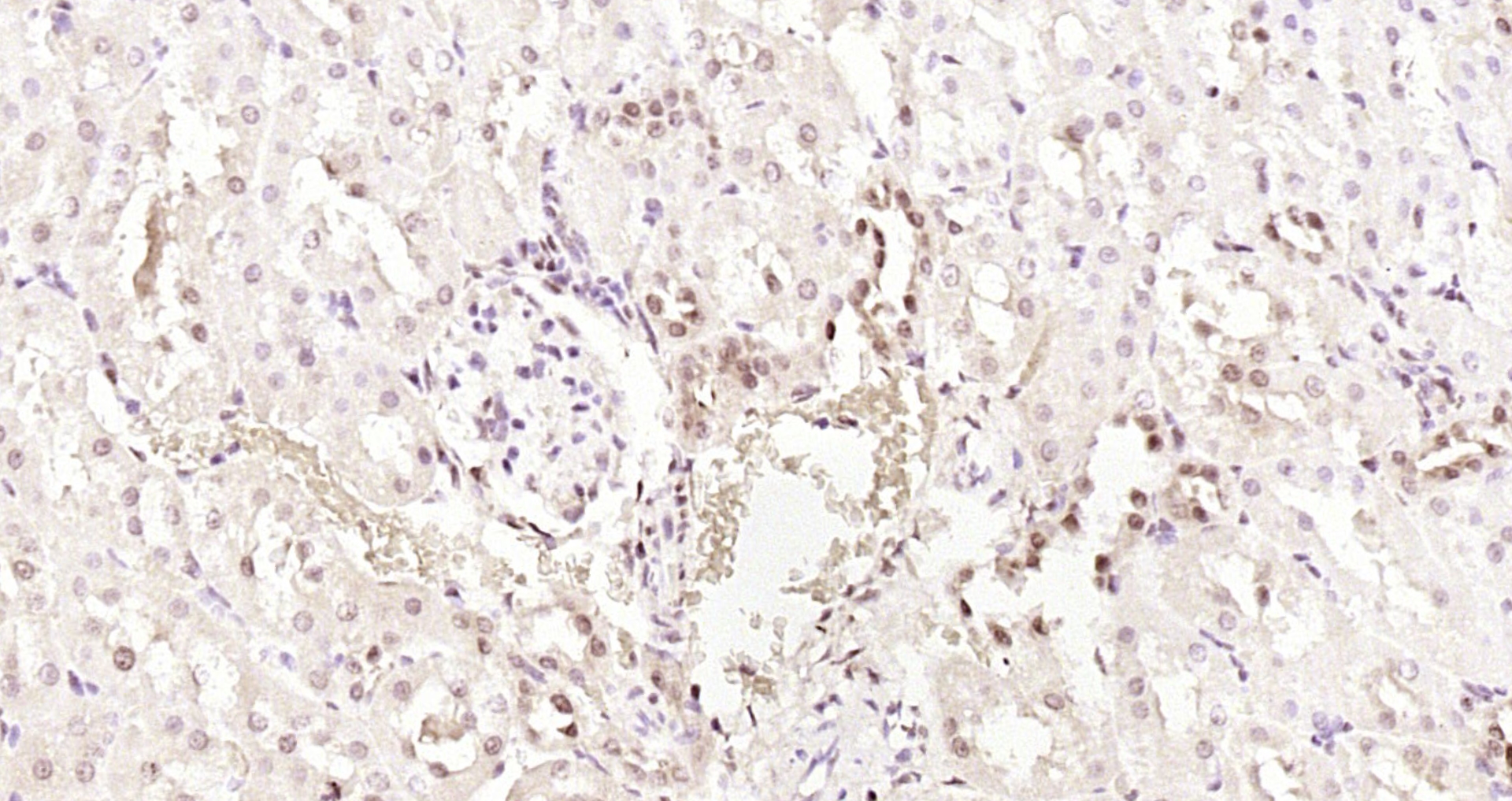 Paraformaldehyde-fixed, paraffin embedded Rat kidney; Antigen retrieval by boiling in sodium citrate buffer (pH6.0) for 15min; Block endogenous peroxidase by 3% hydrogen peroxide for 20 minutes; Blocking buffer (normal goat serum) at 37°C for 30min; Antibody incubation with PTK5 Polyclonal Antibody, Unconjugated (bs-6382R) at 1:200 overnight at 4°C, DAB staining.