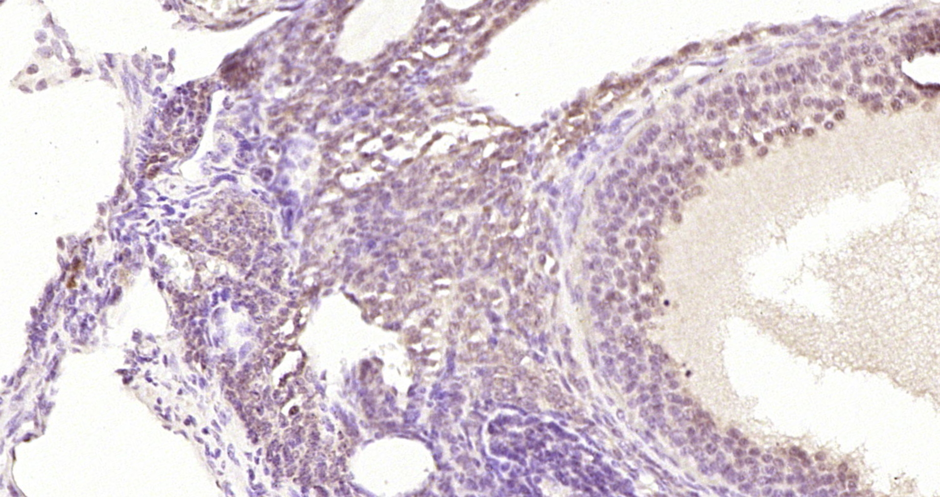 Paraformaldehyde-fixed, paraffin embedded Mouse ovarian; Antigen retrieval by boiling in sodium citrate buffer (pH6.0) for 15min; Block endogenous peroxidase by 3% hydrogen peroxide for 20 minutes; Blocking buffer (normal goat serum) at 37°C for 30min; Antibody incubation with MDM2BP Polyclonal Antibody, Unconjugated (bs-6388R) at 1:200 overnight at 4°C, DAB staining.
