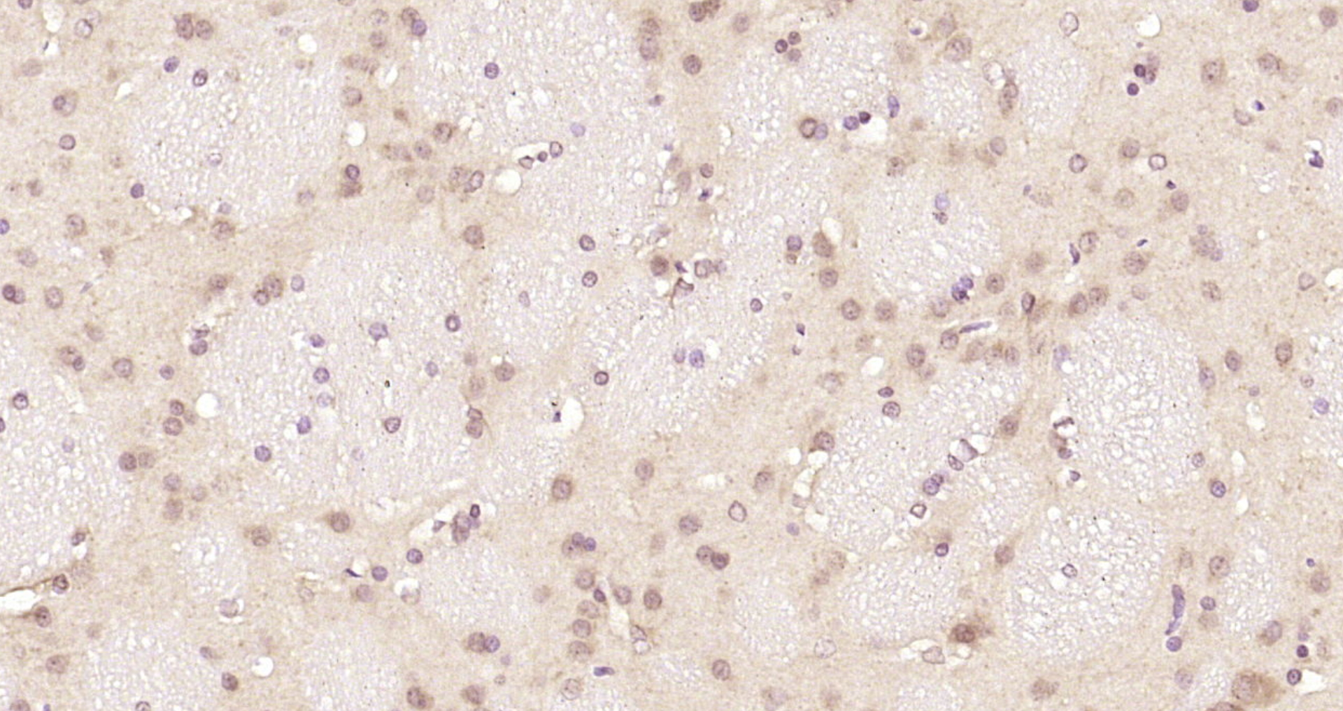 Paraformaldehyde-fixed, paraffin embedded Rat brain; Antigen retrieval by boiling in sodium citrate buffer (pH6.0) for 15min; Block endogenous peroxidase by 3% hydrogen peroxide for 20 minutes; Blocking buffer (normal goat serum) at 37°C for 30min; Antibody incubation with PCNP Polyclonal Antibody, Unconjugated (bs-6392R) at 1:200 overnight at 4°C, DAB staining.