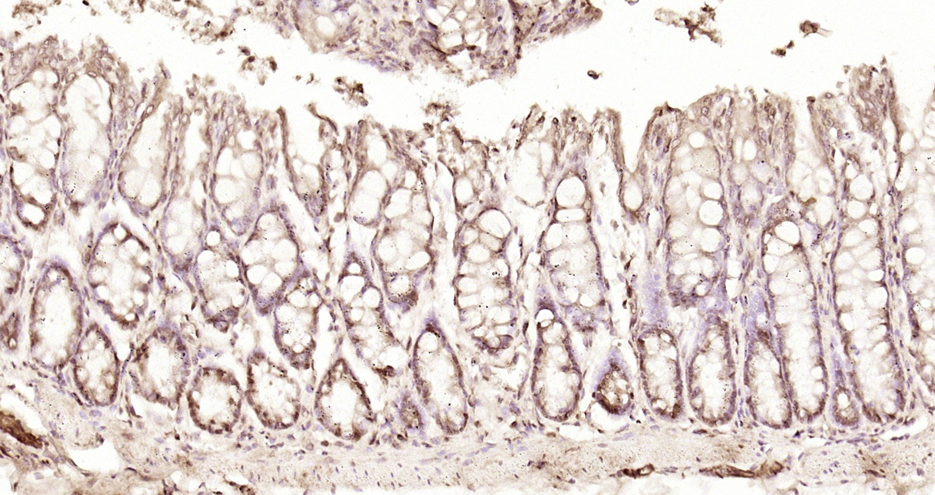 Paraformaldehyde-fixed, paraffin embedded Rat colon; Antigen retrieval by boiling in sodium citrate buffer (pH6.0) for 15min; Block endogenous peroxidase by 3% hydrogen peroxide for 20 minutes; Blocking buffer (normal goat serum) at 37°C for 30min; Antibody incubation with CLLD8 Polyclonal Antibody, Unconjugated (bs-6414R) at 1:200 overnight at 4°C, DAB staining.