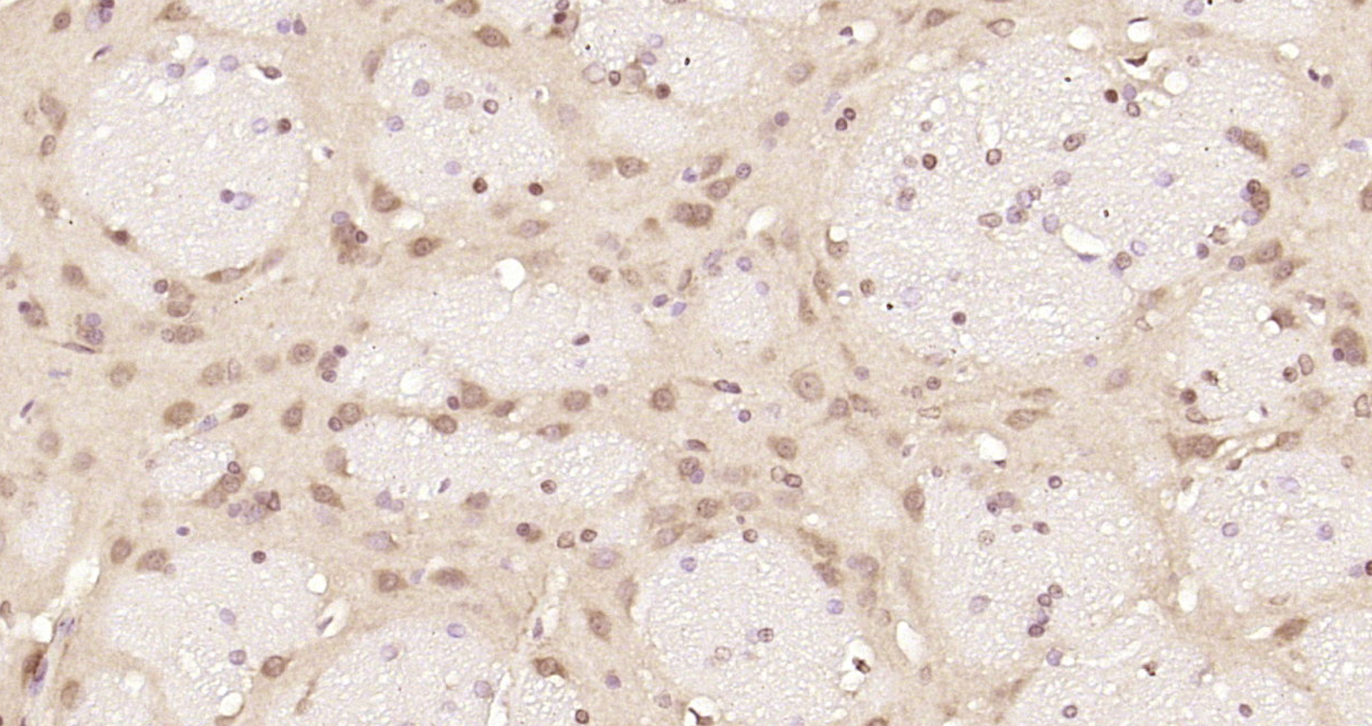 Paraformaldehyde-fixed, paraffin embedded Rat brain; Antigen retrieval by boiling in sodium citrate buffer (pH6.0) for 15min; Block endogenous peroxidase by 3% hydrogen peroxide for 20 minutes; Blocking buffer (normal goat serum) at 37°C for 30min; Antibody incubation with HNRPC Polyclonal Antibody, Unconjugated (bs-6459R) at 1:200 overnight at 4°C, DAB staining.