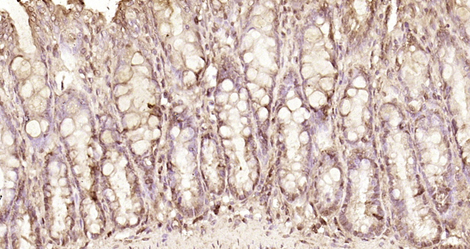 Paraformaldehyde-fixed, paraffin embedded Rat colon; Antigen retrieval by boiling in sodium citrate buffer (pH6.0) for 15min; Block endogenous peroxidase by 3% hydrogen peroxide for 20 minutes; Blocking buffer (normal goat serum) at 37°C for 30min; Antibody incubation with NOL8 Polyclonal Antibody, Unconjugated (bs-6554R) at 1:200 overnight at 4°C, DAB staining.