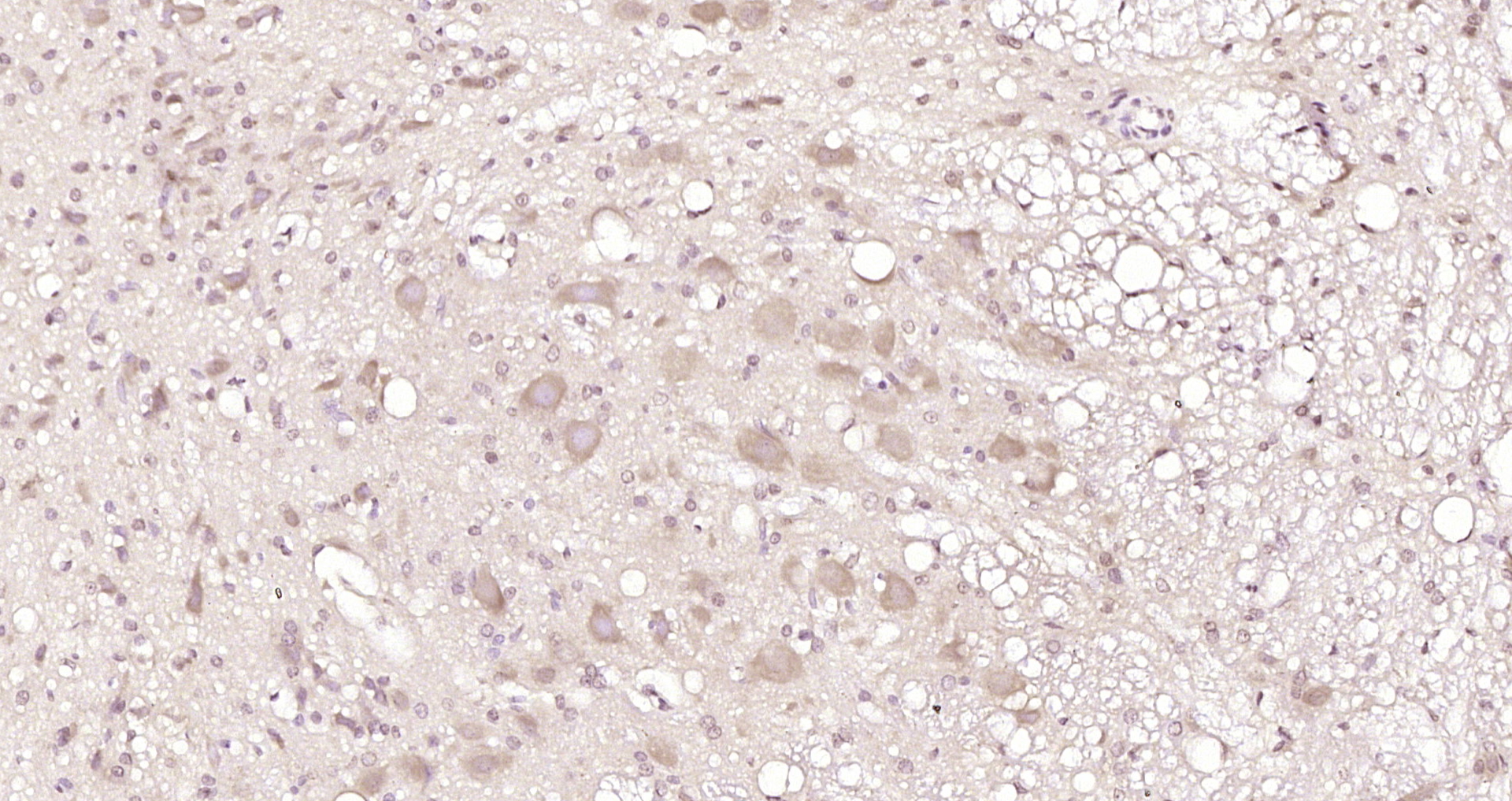 Paraformaldehyde-fixed, paraffin embedded Rat brain; Antigen retrieval by boiling in sodium citrate buffer (pH6.0) for 15min; Block endogenous peroxidase by 3% hydrogen peroxide for 20 minutes; Blocking buffer (normal goat serum) at 37°C for 30min; Antibody incubation with RPL5 Polyclonal Antibody, Unconjugated (bs-6573R) at 1:200 overnight at 4°C, DAB staining.