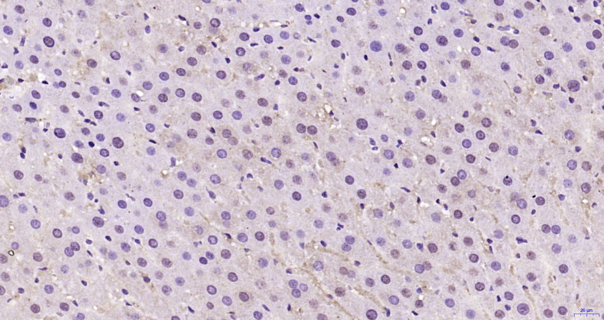 Paraformaldehyde-fixed, paraffin embedded Mouse liver; Antigen retrieval by boiling in sodium citrate buffer (pH6.0) for 15min; Block endogenous peroxidase by 3% hydrogen peroxide for 20 minutes; Blocking buffer (normal goat serum) at 37°C for 30min; Antibody incubation with A1CF Polyclonal Antibody, Unconjugated (bs-6773R) at 1:200 overnight at 4°C, DAB staining.