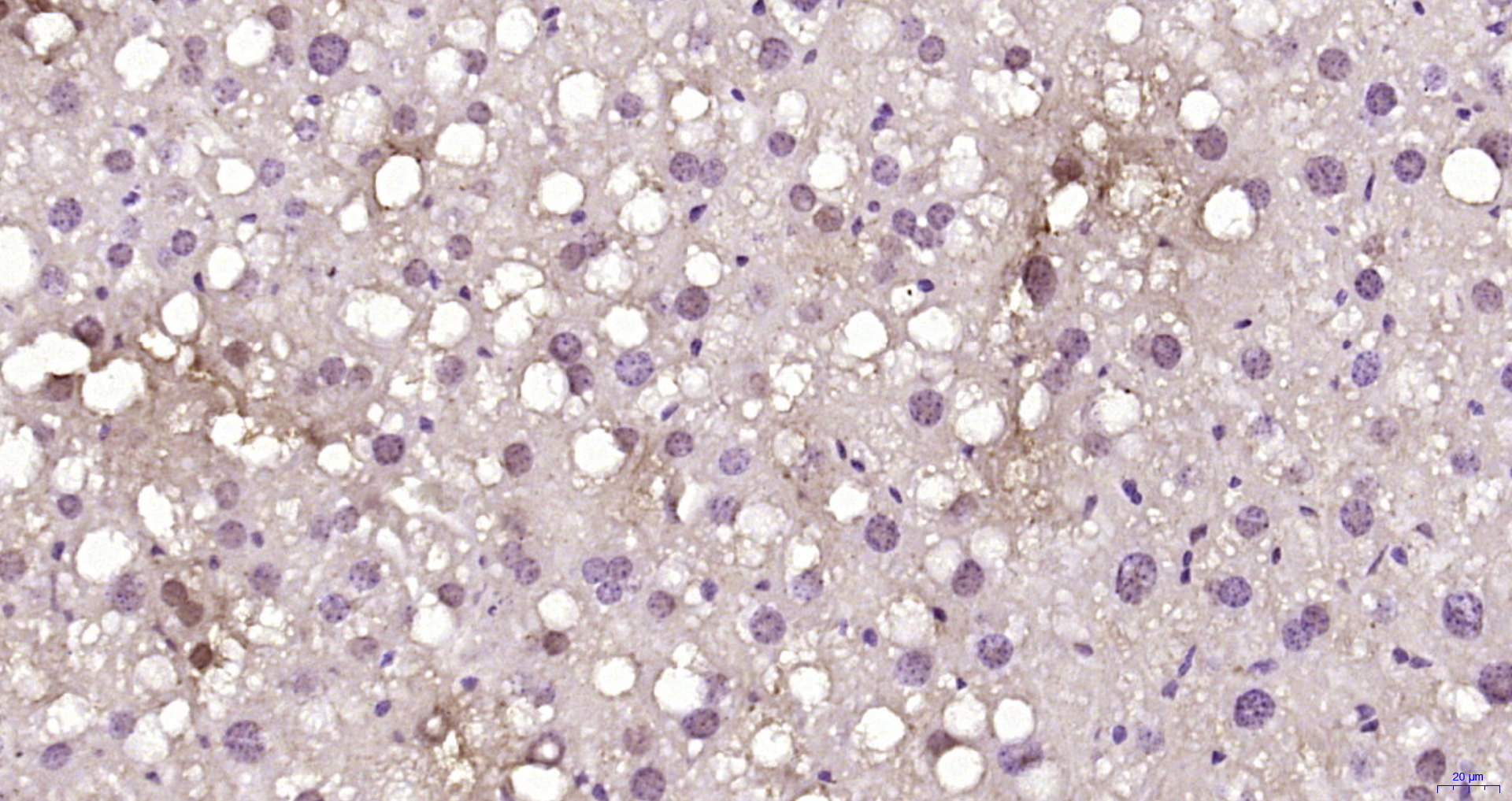 Paraformaldehyde-fixed, paraffin embedded Rat liver; Antigen retrieval by boiling in sodium citrate buffer (pH6.0) for 15min; Block endogenous peroxidase by 3% hydrogen peroxide for 20 minutes; Blocking buffer (normal goat serum) at 37°C for 30min; Antibody incubation with A1CF Polyclonal Antibody, Unconjugated (bs-6773R) at 1:200 overnight at 4°C, DAB staining.
