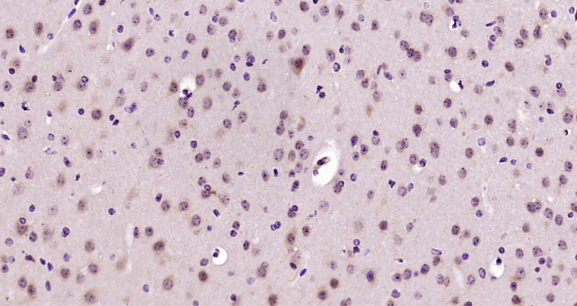 Paraformaldehyde-fixed, paraffin embedded Mouse brain; Antigen retrieval by boiling in sodium citrate buffer (pH6.0) for 15min; Block endogenous peroxidase by 3% hydrogen peroxide for 20 minutes; Blocking buffer (normal goat serum) at 37°C for 30min; Antibody incubation with CARD7 Polyclonal Antibody, Unconjugated (bs-6854R) at 1:200 overnight at 4°C, DAB staining.