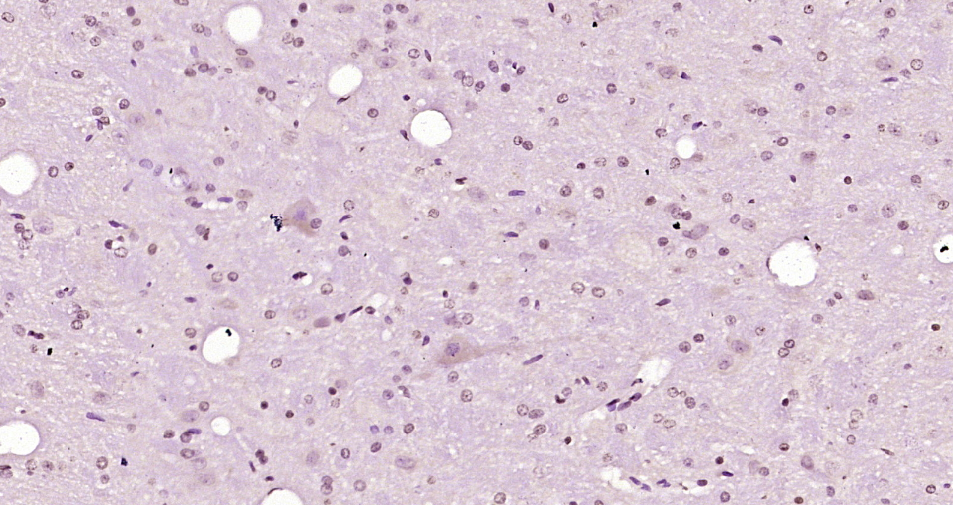 Paraformaldehyde-fixed, paraffin embedded Rat brain; Antigen retrieval by boiling in sodium citrate buffer (pH6.0) for 15min; Block endogenous peroxidase by 3% hydrogen peroxide for 20 minutes; Blocking buffer (normal goat serum) at 37°C for 30min; Antibody incubation with CCDC17 Polyclonal Antibody, Unconjugated (bs-6928R) at 1:200 overnight at 4°C, DAB staining.