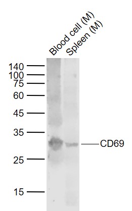Lane 1: Mouse Blood cell lysates; Lane 2: Mouse Spleen lysates probed with CD69 Polyclonal Antibody, Unconjugated (bs-2499R) at 1:1000 dilution and 4˚C overnight incubation. Followed by conjugated secondary antibody incubation at 1:20000 for 60 min at 37˚C.