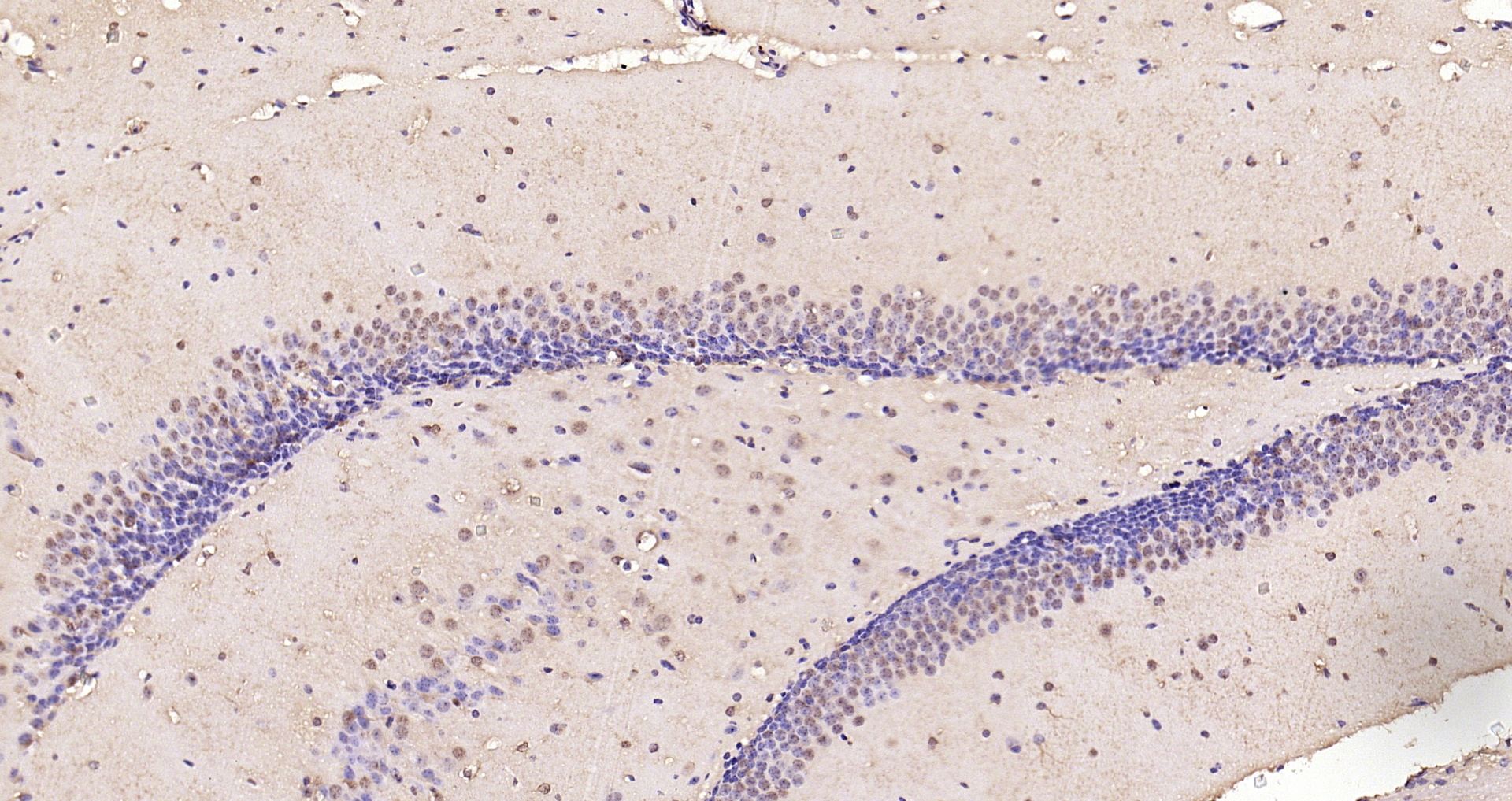 Paraformaldehyde-fixed, paraffin embedded Mouse brain; Antigen retrieval by boiling in sodium citrate buffer (pH6.0) for 15min; Block endogenous peroxidase by 3% hydrogen peroxide for 20 minutes; Blocking buffer (normal goat serum) at 37°C for 30min; Antibody incubation with Smad3 (Ser423 + Ser425) Polyclonal Antibody, Unconjugated (bs-3425R) at 1:200 overnight at 4°C, DAB staining.