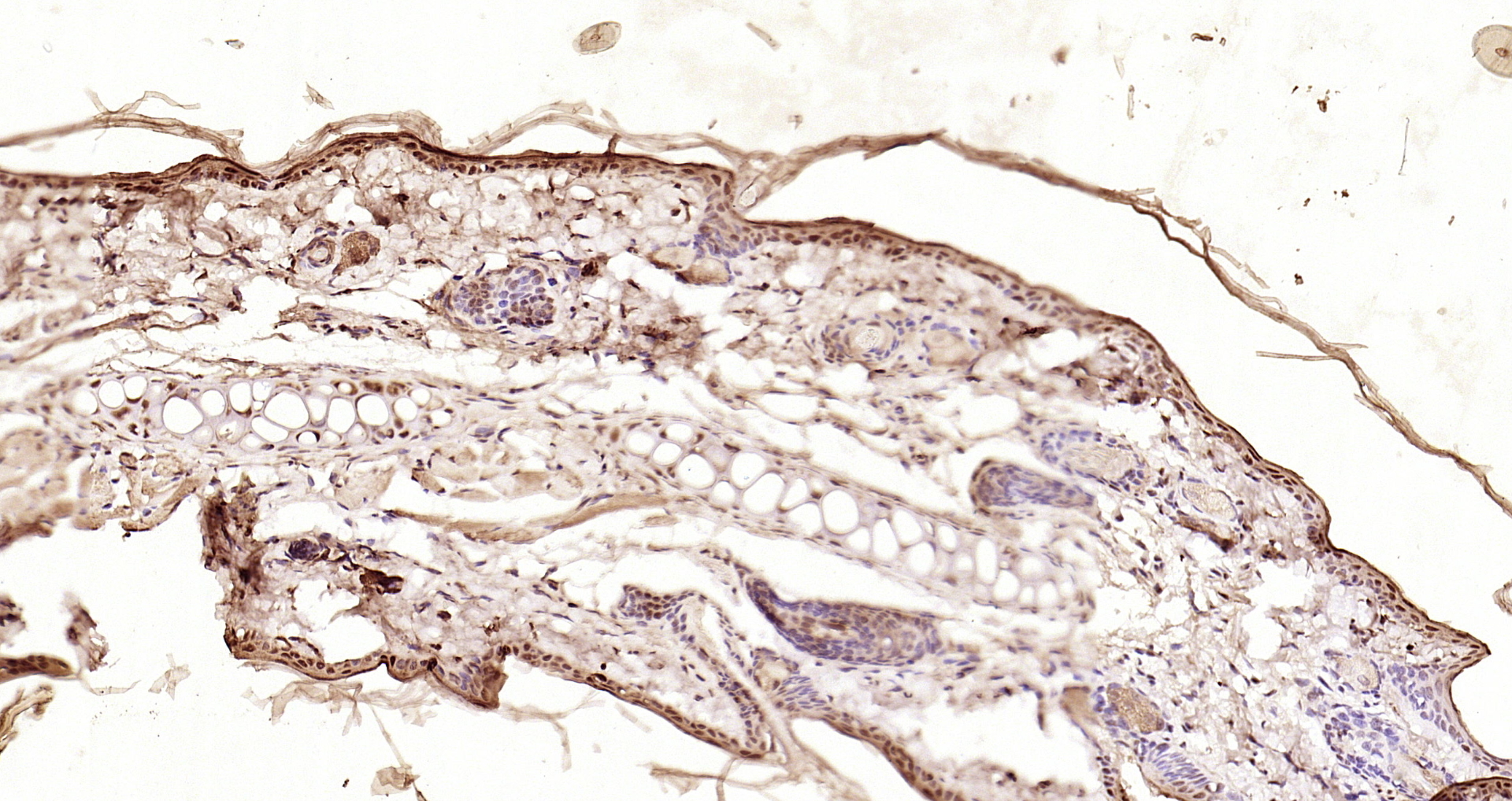 Paraformaldehyde-fixed, paraffin embedded Mouse skin; Antigen retrieval by boiling in sodium citrate buffer (pH6.0) for 15min; Block endogenous peroxidase by 3% hydrogen peroxide for 20 minutes; Blocking buffer (normal goat serum) at 37°C for 30min; Antibody incubation with Smad3 (Ser423 + Ser425) Polyclonal Antibody, Unconjugated (bs-3425R) at 1:200 overnight at 4°C, DAB staining.