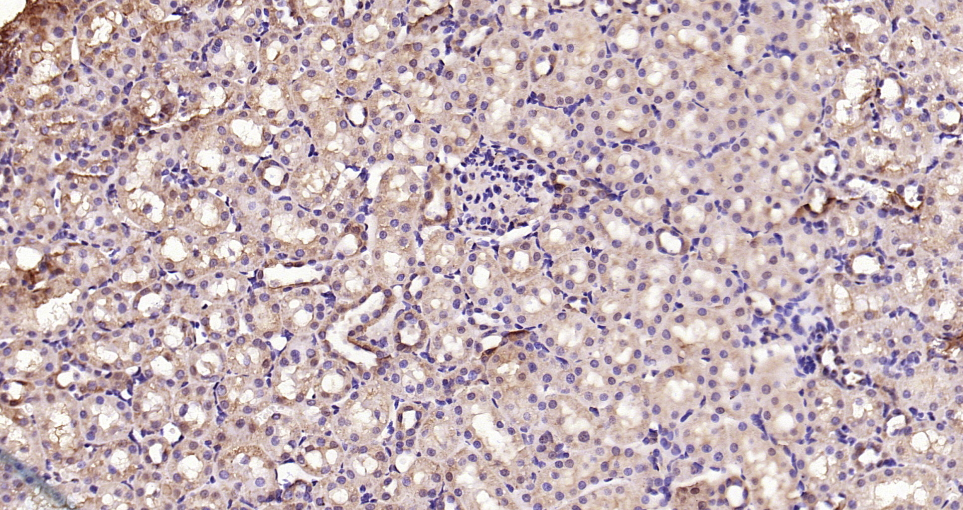 Paraformaldehyde-fixed, paraffin embedded Mouse kidney; Antigen retrieval by boiling in sodium citrate buffer (pH6.0) for 15min; Block endogenous peroxidase by 3% hydrogen peroxide for 20 minutes; Blocking buffer (normal goat serum) at 37°C for 30min; Antibody incubation with Smad3 (Ser423 + Ser425) Polyclonal Antibody, Unconjugated (bs-3425R) at 1:200 overnight at 4°C, DAB staining.