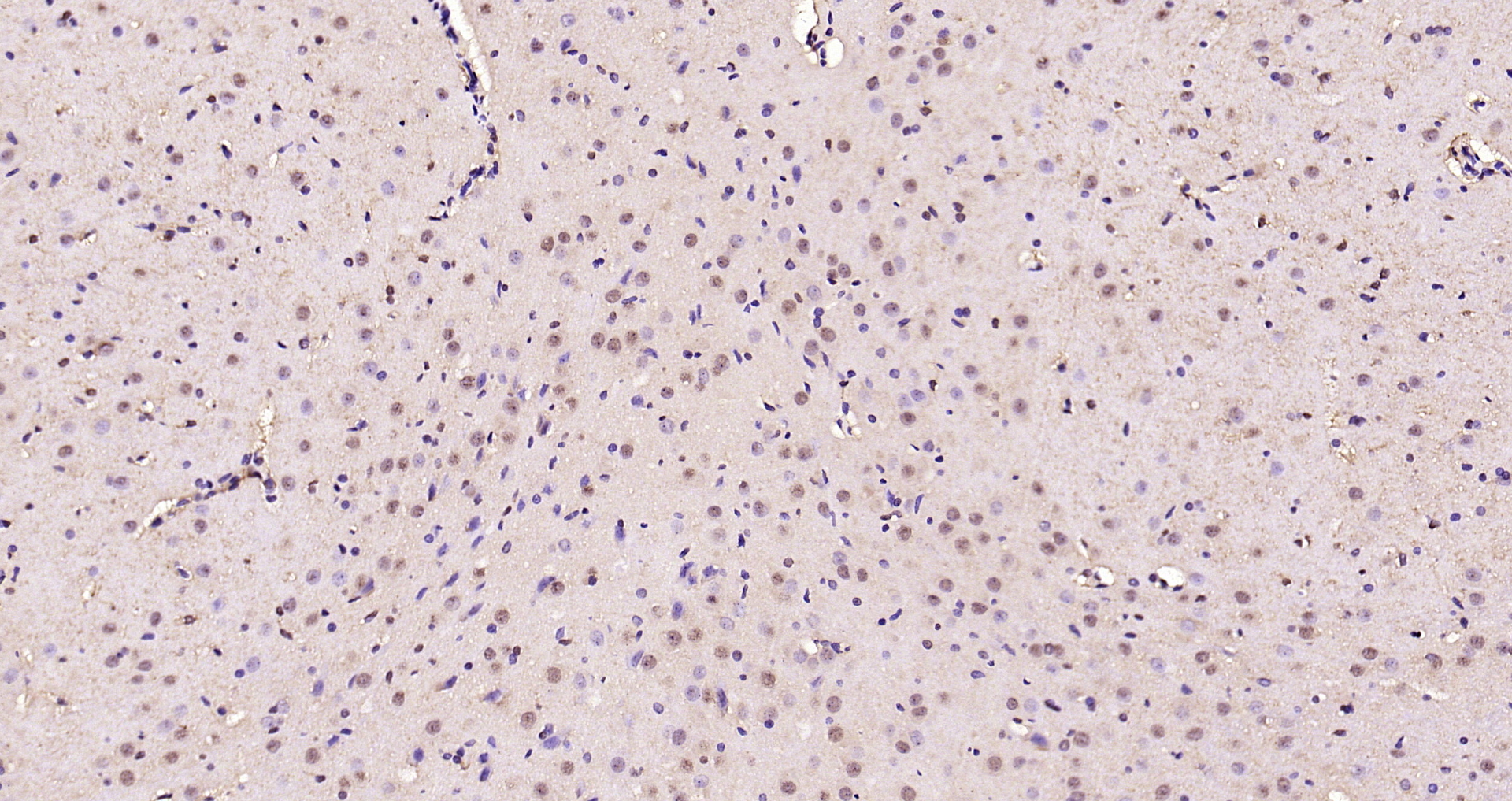 Paraformaldehyde-fixed, paraffin embedded Rat brain; Antigen retrieval by boiling in sodium citrate buffer (pH6.0) for 15min; Block endogenous peroxidase by 3% hydrogen peroxide for 20 minutes; Blocking buffer (normal goat serum) at 37°C for 30min; Antibody incubation with Smad3 (Ser423 + Ser425) Polyclonal Antibody, Unconjugated (bs-3425R) at 1:200 overnight at 4°C, DAB staining.
