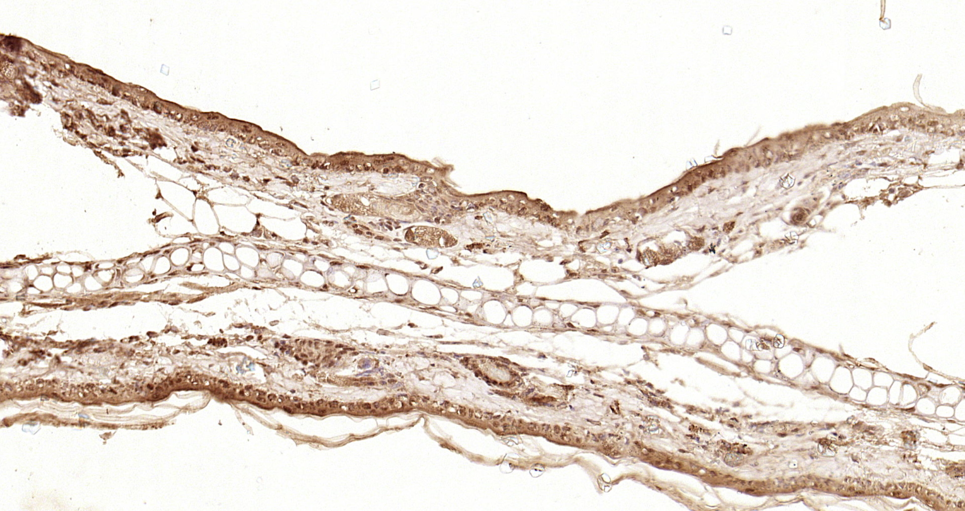 Paraformaldehyde-fixed, paraffin embedded Rat skin; Antigen retrieval by boiling in sodium citrate buffer (pH6.0) for 15min; Block endogenous peroxidase by 3% hydrogen peroxide for 20 minutes; Blocking buffer (normal goat serum) at 37°C for 30min; Antibody incubation with Smad3 (Ser423 + Ser425) Polyclonal Antibody, Unconjugated (bs-3425R) at 1:200 overnight at 4°C, DAB staining.