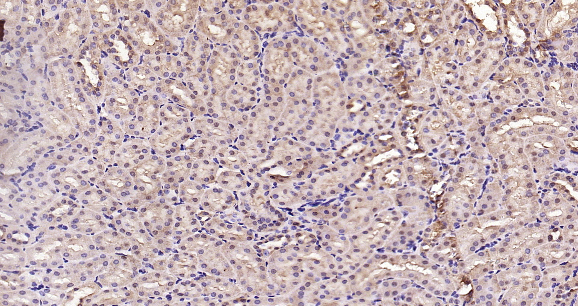 Paraformaldehyde-fixed, paraffin embedded Rat kidney; Antigen retrieval by boiling in sodium citrate buffer (pH6.0) for 15min; Block endogenous peroxidase by 3% hydrogen peroxide for 20 minutes; Blocking buffer (normal goat serum) at 37°C for 30min; Antibody incubation with Smad3 (Ser423 + Ser425) Polyclonal Antibody, Unconjugated (bs-3425R) at 1:200 overnight at 4°C, DAB staining.