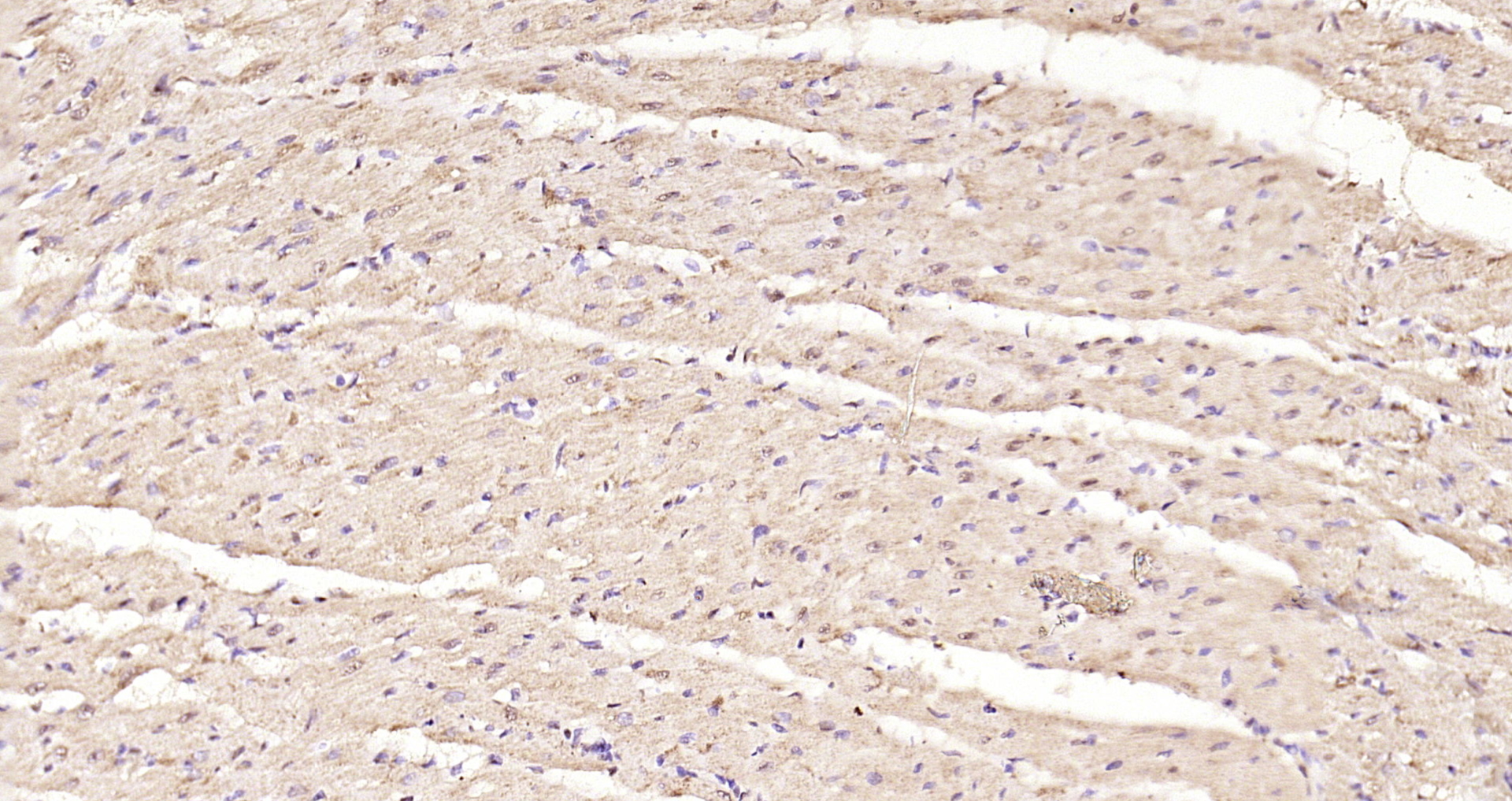 Paraformaldehyde-fixed, paraffin embedded Rat heart; Antigen retrieval by boiling in sodium citrate buffer (pH6.0) for 15min; Block endogenous peroxidase by 3% hydrogen peroxide for 20 minutes; Blocking buffer (normal goat serum) at 37°C for 30min; Antibody incubation with Smad3 (Ser423 + Ser425) Polyclonal Antibody, Unconjugated (bs-3425R) at 1:200 overnight at 4°C, DAB staining.