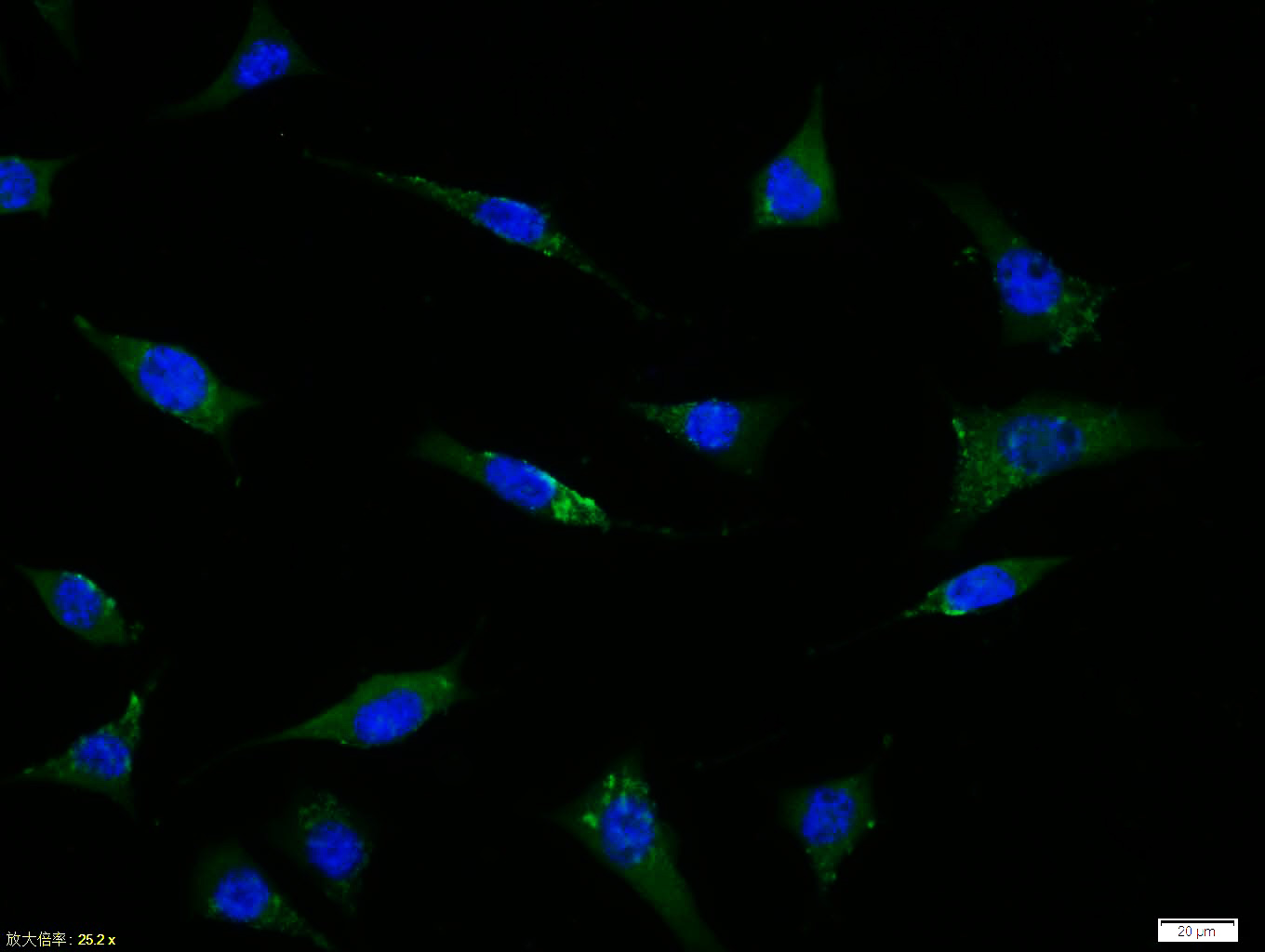 Tissue/cell:sh-sy5y cell; 4% Paraformaldehyde-fixed; Triton X-100 at room temperature for 20 min; Blocking buffer (normal goat serum, C-0005) at 37°C for 20 min; Antibody incubation with (GPR30) polyclonal Antibody, Unconjugated (bs-1380R) 1:100, 90 minutes at 37°C; followed by a FITC conjugated Goat Anti-Rabbit IgG antibody at 37°C for 90 minutes, DAPI (blue, C02-04002) was used to stain the cell nuclei.
