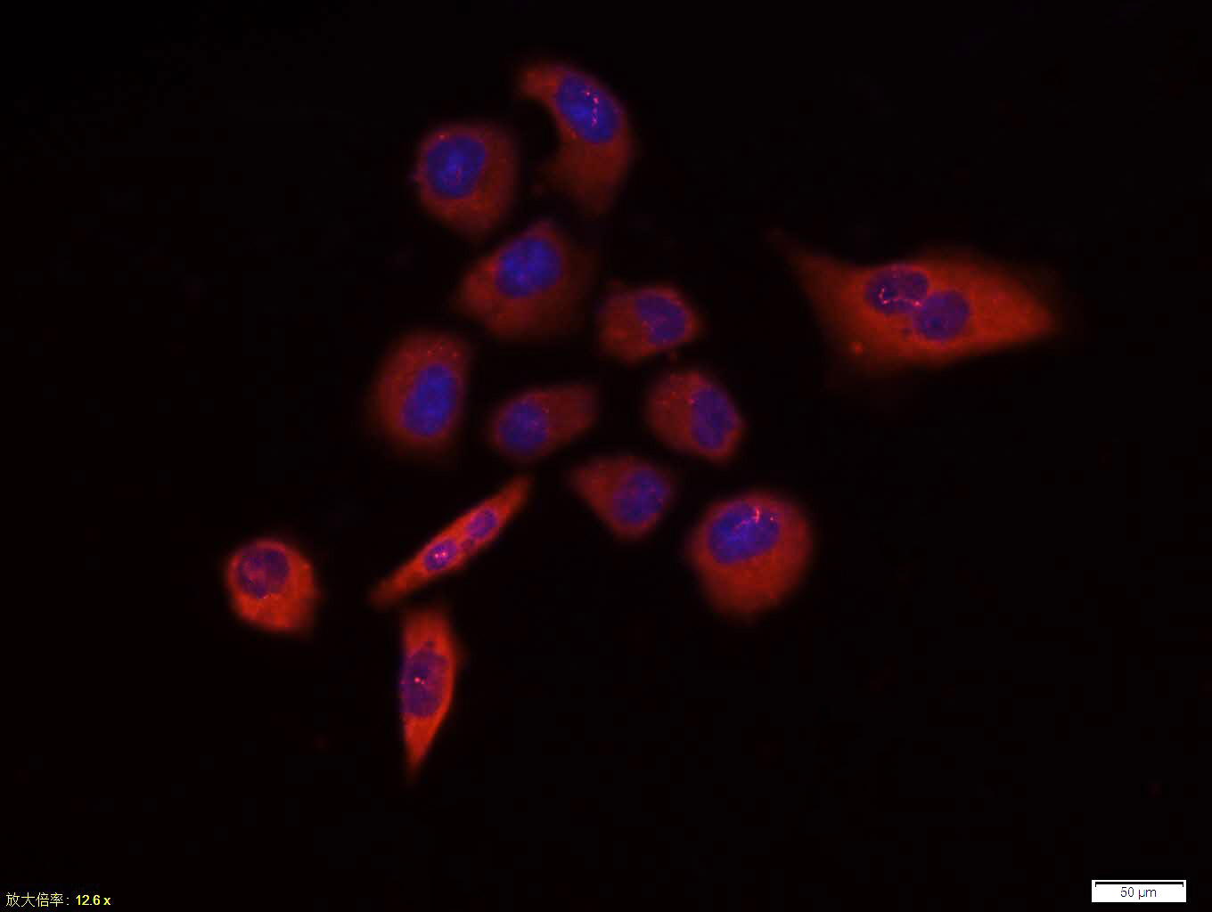 Tissue/cell:Hela cell; 4% Paraformaldehyde-fixed; Triton X-100 at room temperature for 20 min; Blocking buffer (normal goat serum, C-0005) at 37°C for 20 min; Antibody incubation with (GSK-3 beta) polyclonal Antibody, Unconjugated (bs-0023M) 1:100, 90 minutes at 37°C; followed by a CY5 conjugated Goat Anti-Mouse IgG antibody at 37°C for 90 minutes, DAPI (blue, C02-04002) was used to stain the cell nuclei.