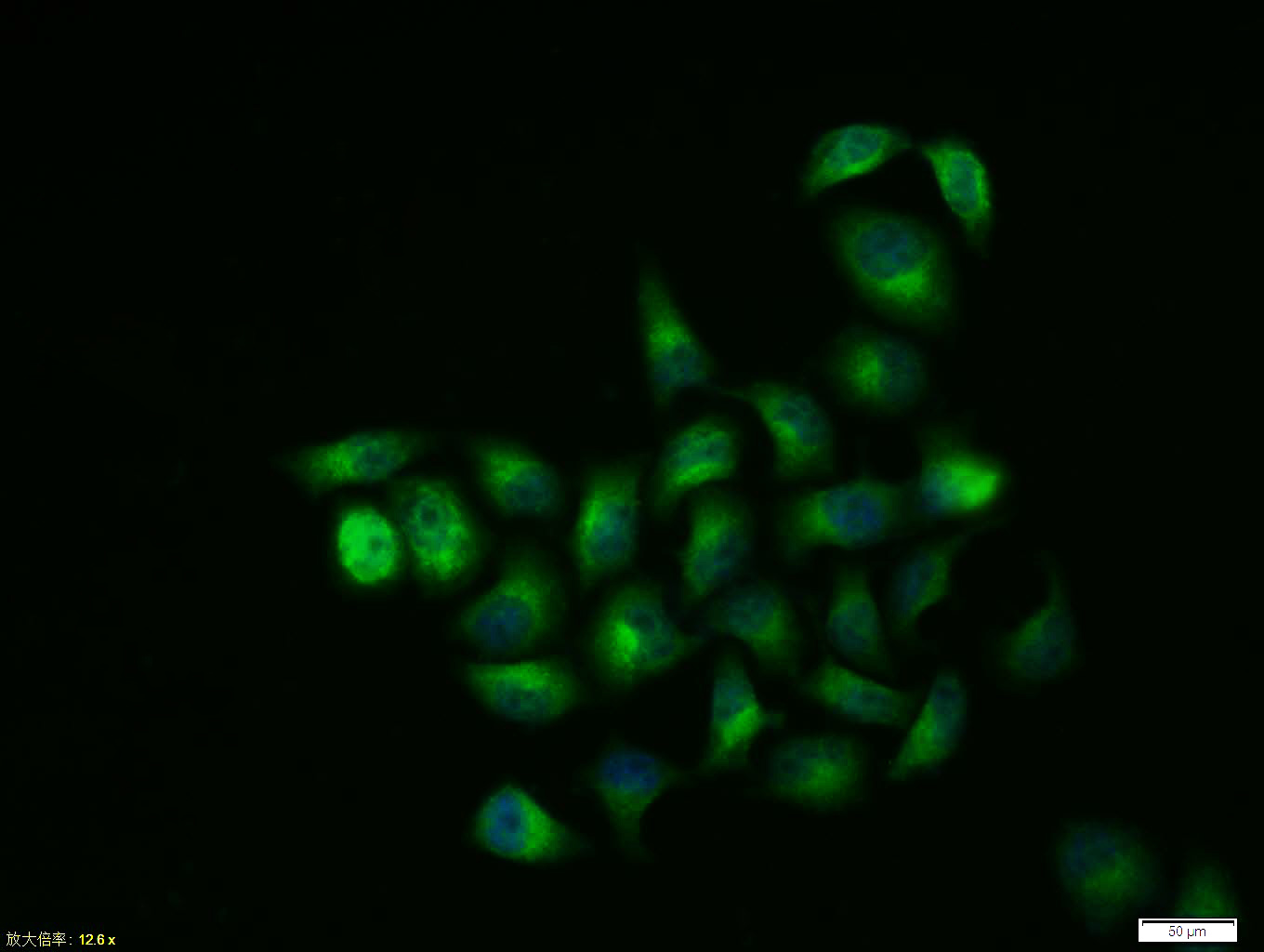 Tissue/cell:Hela cell; 4% Paraformaldehyde-fixed; Triton X-100 at room temperature for 20 min; Blocking buffer (normal goat serum, C-0005) at 37°C for 20 min; Antibody incubation with (GSK-3 Beta) polyclonal Antibody, Unconjugated (bs-0028R) 1:100, 90 minutes at 37°C; followed by a FITC conjugated Goat Anti-Rabbit IgG antibody at 37°C for 90 minutes, DAPI (blue, C02-04002) was used to stain the cell nuclei