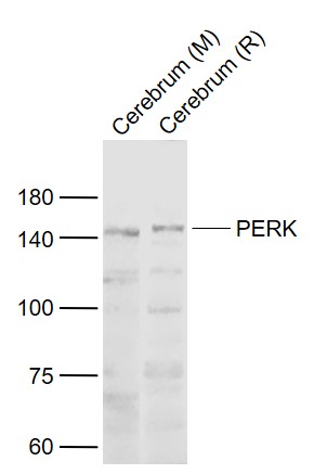 Lane 1: Mouse Cerebrum lysates; Lane 2: Rat Cerebrum lysates probed with PERK Polyclonal Antibody, Unconjugated (bs-2469R) at 1:1000 dilution and 4˚C overnight incubation. Followed by conjugated secondary antibody incubation at 1:20000 for 60 min at 37˚C.