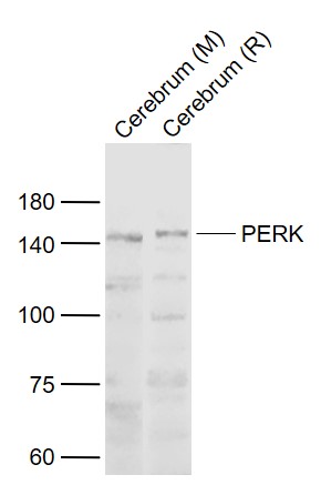 Lane 1: Mouse Cerebrum lysates; Lane 2: Rat Cerebrum lysates probed with PERK Polyclonal Antibody, Unconjugated (bs-2469R) at 1:1000 dilution and 4˚C overnight incubation. Followed by conjugated secondary antibody incubation at 1:20000 for 60 min at 37˚C.