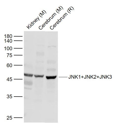 Lane 1: Mouse Kidney lysates; Lane 2: Mouse Cerebrum lysates; Lane 3: Rat Cerebrum lysates probed with JNK1+2+3 Polyclonal  Antibody, Unconjugated (bs-2592R) at 1:1000 dilution and 4˚C overnight incubation. Followed by conjugated secondary antibody incubation at 1:20000 for 60 min at 37˚C.