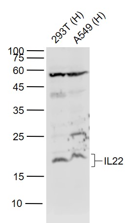 Lane 1: Human 293T cell lysates; Lane 2: Human A549 cell lysates probed with IL-22 Polyclonal Antibody, Unconjugated (bs-2623R) at 1:1000 dilution and 4˚C overnight incubation. Followed by conjugated secondary antibody incubation at 1:20000 for 60 min at 37˚C.
