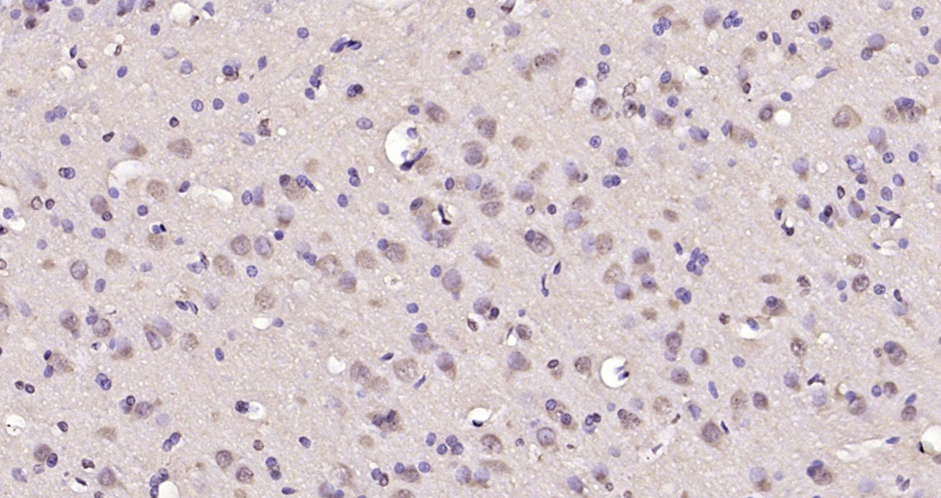 Paraformaldehyde-fixed, paraffin embedded Rat brain; Antigen retrieval by boiling in sodium citrate buffer (pH6.0) for 15min; Block endogenous peroxidase by 3% hydrogen peroxide for 20 minutes; Blocking buffer (normal goat serum) at 37°C for 30min; Antibody incubation with TP53TG5 Polyclonal Antibody, Unconjugated (bs-7702R) at 1:200 overnight at 4°C, DAB staining.