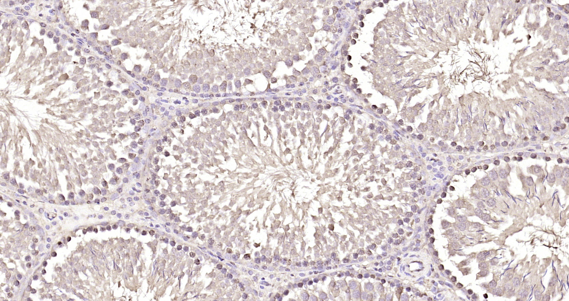Paraformaldehyde-fixed, paraffin embedded Rat testis; Antigen retrieval by boiling in sodium citrate buffer (pH6.0) for 15min; Block endogenous peroxidase by 3% hydrogen peroxide for 20 minutes; Blocking buffer (normal goat serum) at 37°C for 30min; Antibody incubation with TP53TG5 Polyclonal Antibody, Unconjugated (bs-7702R) at 1:200 overnight at 4°C, DAB staining.