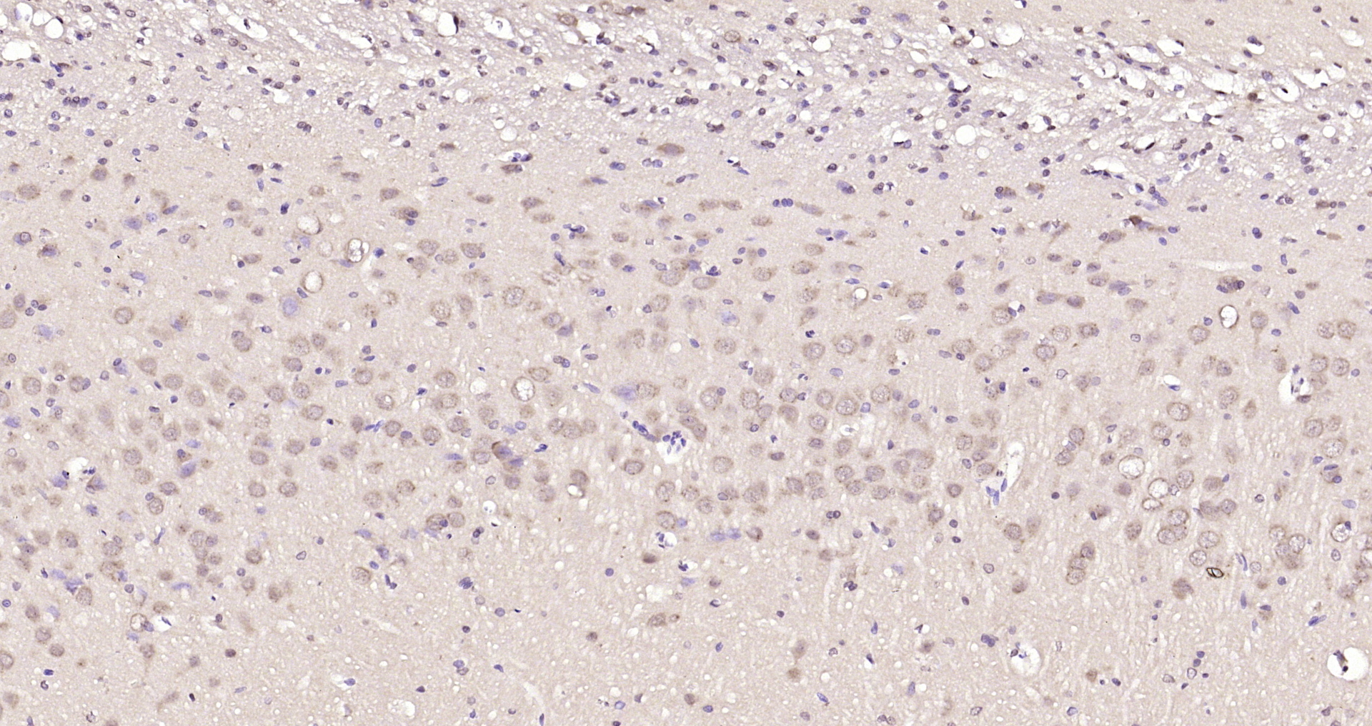 Paraformaldehyde-fixed, paraffin embedded Rat brain; Antigen retrieval by boiling in sodium citrate buffer (pH6.0) for 15min; Block endogenous peroxidase by 3% hydrogen peroxide for 20 minutes; Blocking buffer (normal goat serum) at 37°C for 30min; Antibody incubation with Retinoic acid induced 17 Polyclonal Antibody, Unconjugated (bs-7709R) at 1:200 overnight at 4°C, DAB staining.