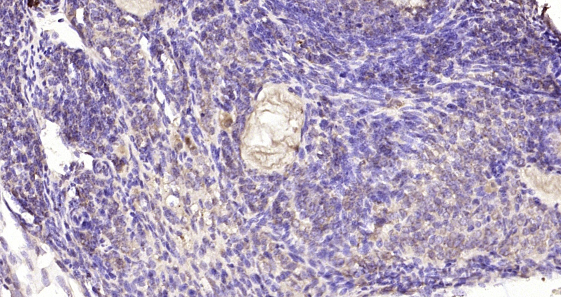 Paraformaldehyde-fixed, paraffin embedded Mouse ovarian; Antigen retrieval by boiling in sodium citrate buffer (pH6.0) for 15min; Block endogenous peroxidase by 3% hydrogen peroxide for 20 minutes; Blocking buffer (normal goat serum) at 37°C for 30min; Antibody incubation with Retinoic acid induced 17 Polyclonal Antibody, Unconjugated (bs-7709R) at 1:200 overnight at 4°C, DAB staining.