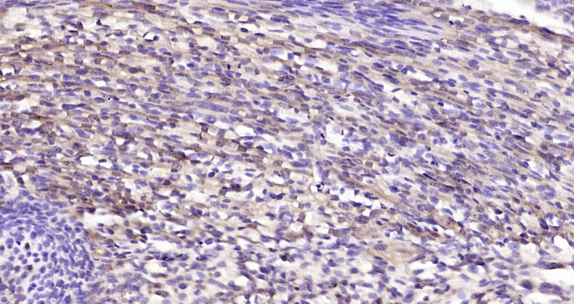 Paraformaldehyde-fixed, paraffin embedded Mouse embryo; Antigen retrieval by boiling in sodium citrate buffer (pH6.0) for 15min; Block endogenous peroxidase by 3% hydrogen peroxide for 20 minutes; Blocking buffer (normal goat serum) at 37°C for 30min; Antibody incubation with CAPD2 Polyclonal Antibody, Unconjugated (bs-7718R) at 1:200 overnight at 4°C, DAB staining.