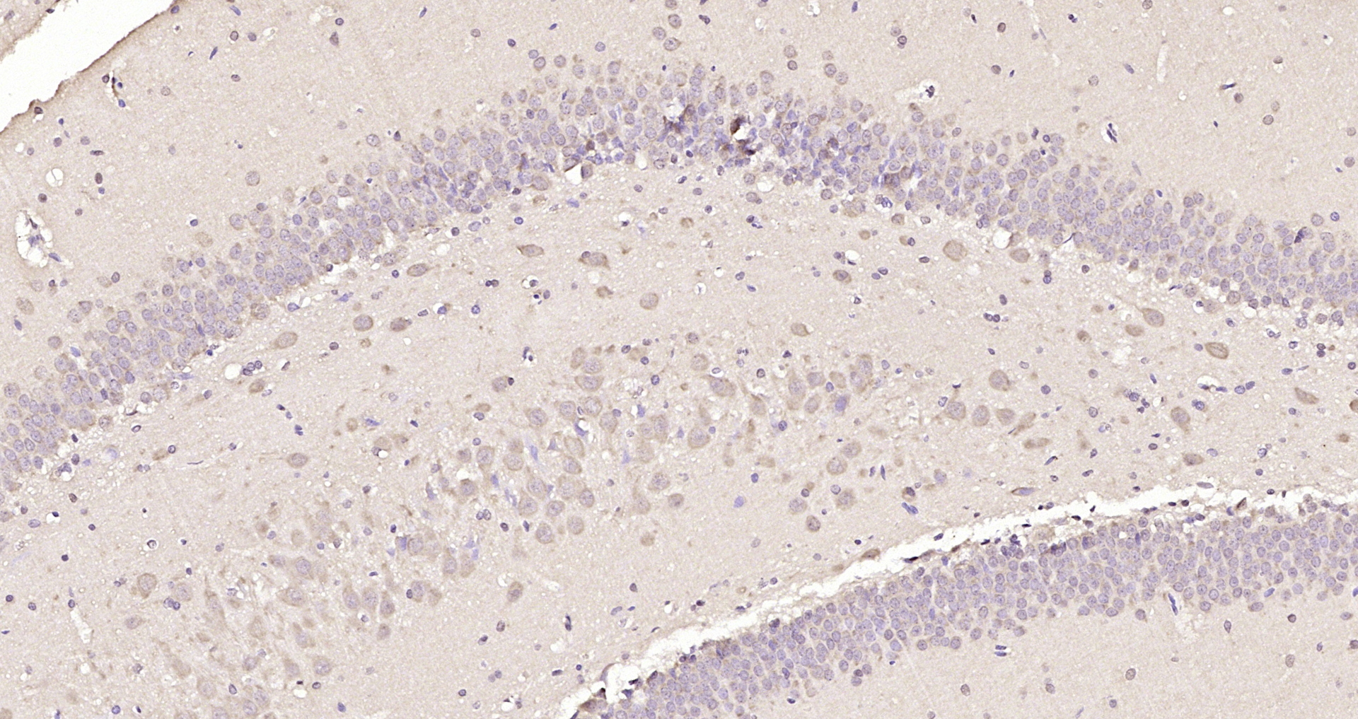 Paraformaldehyde-fixed, paraffin embedded Rat brain; Antigen retrieval by boiling in sodium citrate buffer (pH6.0) for 15min; Block endogenous peroxidase by 3% hydrogen peroxide for 20 minutes; Blocking buffer (normal goat serum) at 37°C for 30min; Antibody incubation with SMC2 Polyclonal Antibody, Unconjugated (bs-7727R) at 1:200 overnight at 4°C, DAB staining.