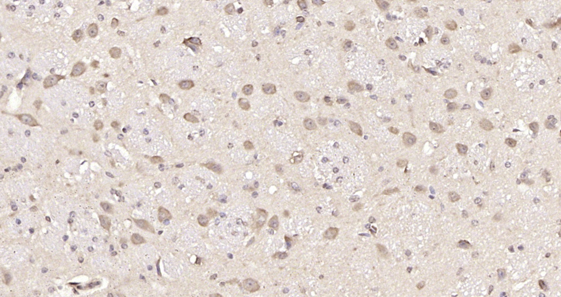 Paraformaldehyde-fixed, paraffin embedded Mouse brain; Antigen retrieval by boiling in sodium citrate buffer (pH6.0) for 15min; Block endogenous peroxidase by 3% hydrogen peroxide for 20 minutes; Blocking buffer (normal goat serum) at 37°C for 30min; Antibody incubation with SMC2 Polyclonal Antibody, Unconjugated (bs-7727R) at 1:200 overnight at 4°C, DAB staining.