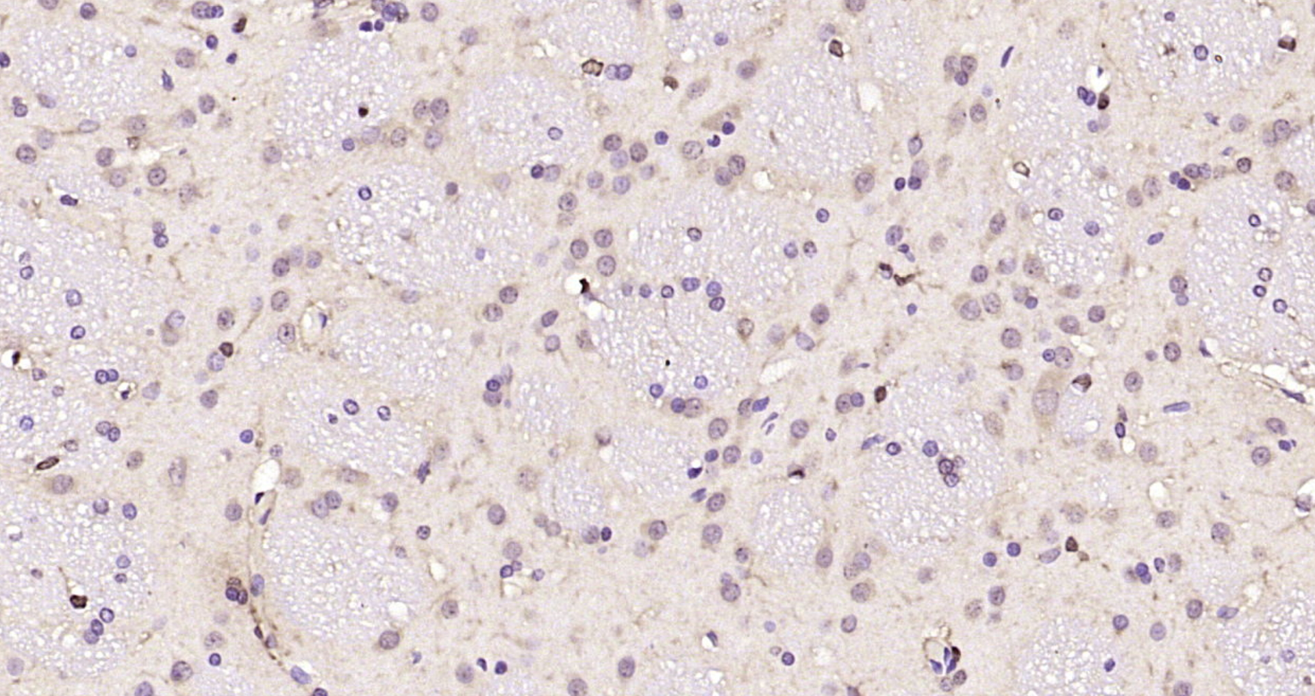 Paraformaldehyde-fixed, paraffin embedded Rat brain; Antigen retrieval by boiling in sodium citrate buffer (pH6.0) for 15min; Block endogenous peroxidase by 3% hydrogen peroxide for 20 minutes; Blocking buffer (normal goat serum) at 37°C for 30min; Antibody incubation with SMC5 Polyclonal Antibody, Unconjugated (bs-7729R) at 1:200 overnight at 4°C, DAB staining.