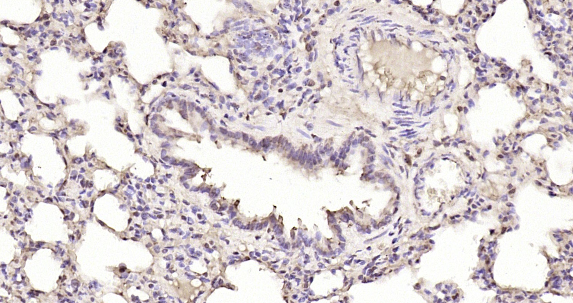 Paraformaldehyde-fixed, paraffin embedded Rat lung; Antigen retrieval by boiling in sodium citrate buffer (pH6.0) for 15min; Block endogenous peroxidase by 3% hydrogen peroxide for 20 minutes; Blocking buffer (normal goat serum) at 37°C for 30min; Antibody incubation with SMC6 Polyclonal Antibody, Unconjugated (bs-7730R) at 1:200 overnight at 4°C, DAB staining.