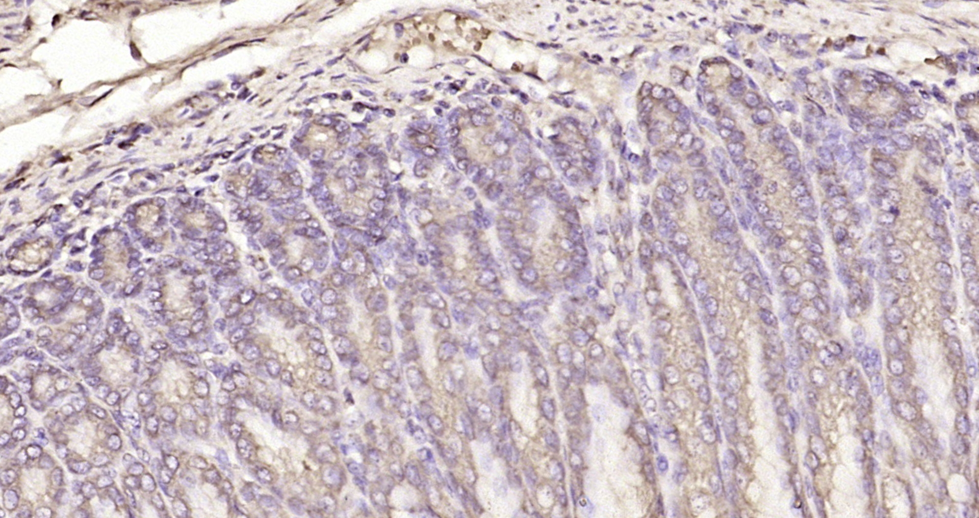 Paraformaldehyde-fixed, paraffin embedded Rat stomach; Antigen retrieval by boiling in sodium citrate buffer (pH6.0) for 15min; Block endogenous peroxidase by 3% hydrogen peroxide for 20 minutes; Blocking buffer (normal goat serum) at 37°C for 30min; Antibody incubation with SMC6 Polyclonal Antibody, Unconjugated (bs-7730R) at 1:200 overnight at 4°C, DAB staining.