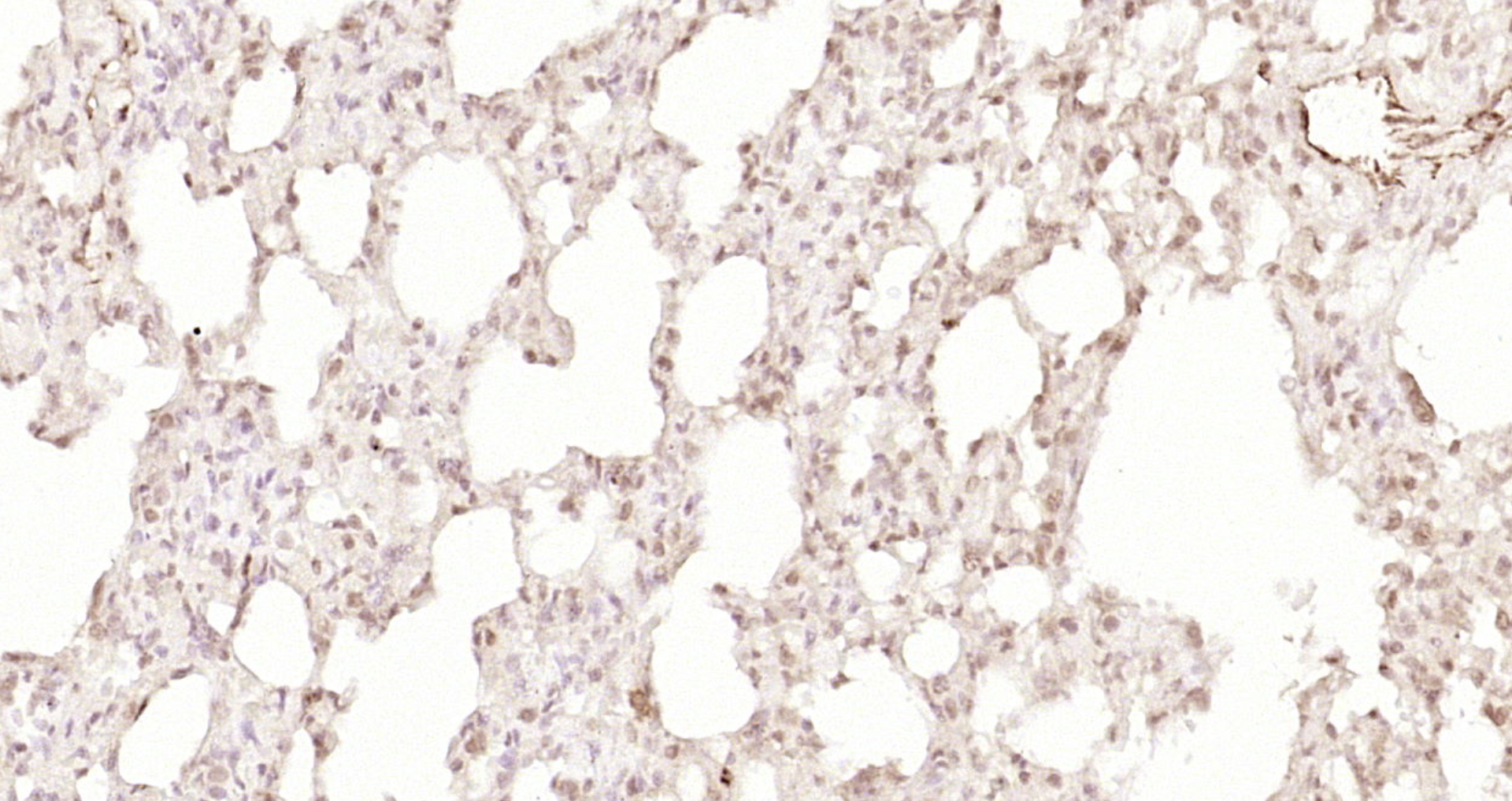 Paraformaldehyde-fixed, paraffin embedded Rat lung; Antigen retrieval by boiling in sodium citrate buffer (pH6.0) for 15min; Block endogenous peroxidase by 3% hydrogen peroxide for 20 minutes; Blocking buffer (normal goat serum) at 37°C for 30min; Antibody incubation with TRIP1 Polyclonal Antibody, Unconjugated (bs-7731R) at 1:200 overnight at 4°C, DAB staining.