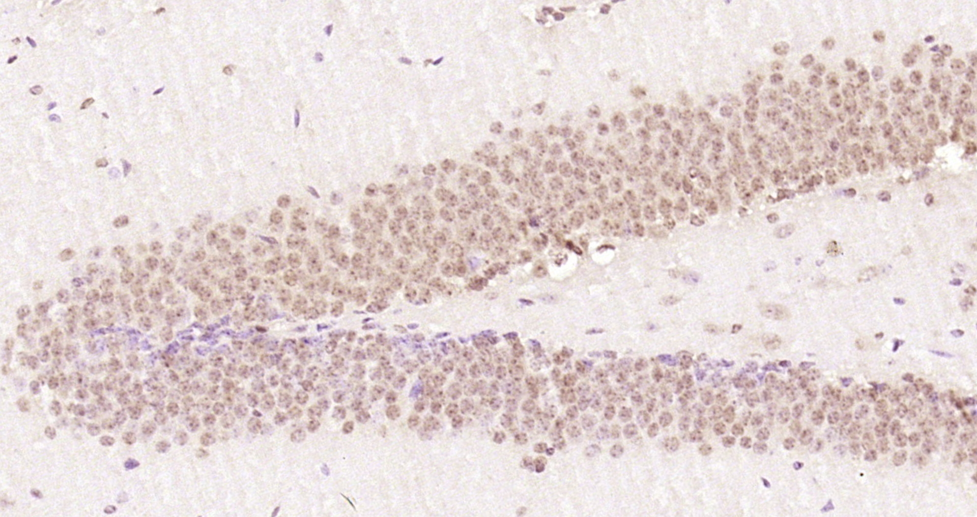 Paraformaldehyde-fixed, paraffin embedded Mouse brain; Antigen retrieval by boiling in sodium citrate buffer (pH6.0) for 15min; Block endogenous peroxidase by 3% hydrogen peroxide for 20 minutes; Blocking buffer (normal goat serum) at 37°C for 30min; Antibody incubation with TRIP1 Polyclonal Antibody, Unconjugated (bs-7731R) at 1:200 overnight at 4°C, DAB staining.