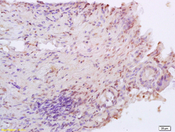 Formalin-fixed and paraffin embedded rat colitis labeled with Anti XRCC4 Polyclonal Antibody, Unconjugated (bs-8510R) at 1:200 followed by conjugation to the secondary antibody and DAB staining