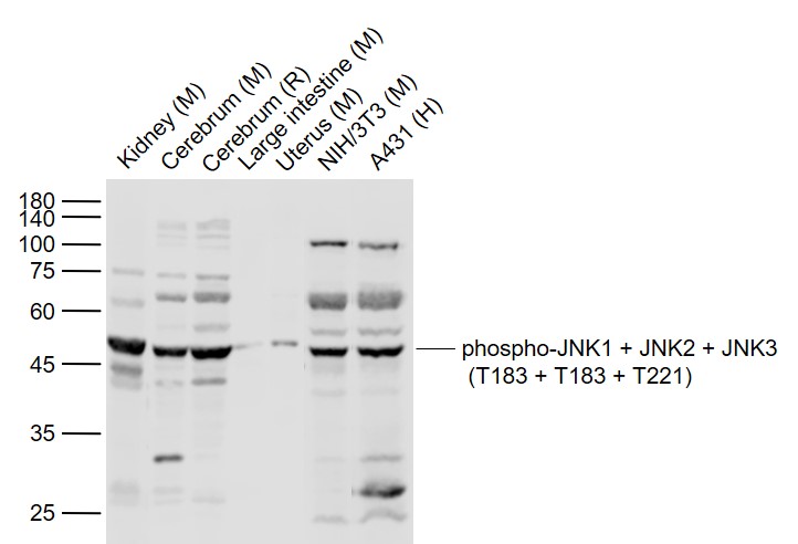 Lane 1: Mouse Kidney lysates; Lane 2: Mouse Cerebrum lysates; Lane 3: Rat Cerebrum lysates; Lane 4: Mouse Large intestine lysates; Lane 5: Mouse Uterus lysates; Lane 6: Mouse NIH/3T3 cell lysates; Lane 7: Human A431 cell lysates probed with JNK1 + JNK2 + JNK3 Polyclonal Antibody, Unconjugated (bs-4163R) at 1:1000 dilution and 4˚C overnight incubation. Followed by conjugated secondary antibody incubation at 1:20000 for 60 min at 37˚C.