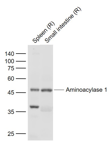 Lane 1: Rat Spleen lysates; Lane 2: Rat Small intestine lysates probed with Aminoacylase 1 Polyclonal Antibody, Unconjugated (bs-6019R) at 1:1000 dilution and 4˚C overnight incubation. Followed by conjugated secondary antibody incubation at 1:20000 for 60 min at 37˚C.