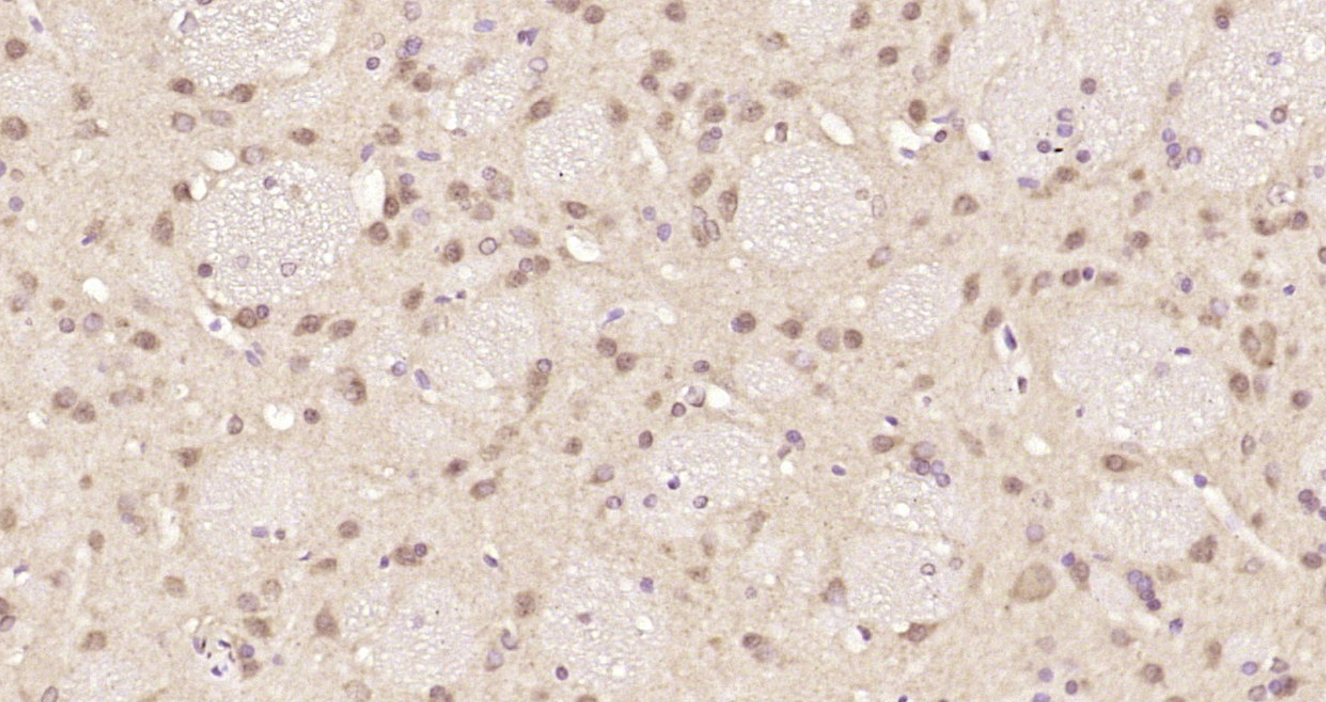 Paraformaldehyde-fixed, paraffin embedded Rat brain; Antigen retrieval by boiling in sodium citrate buffer (pH6.0) for 15min; Block endogenous peroxidase by 3% hydrogen peroxide for 20 minutes; Blocking buffer (normal goat serum) at 37°C for 30min; Antibody incubation with PSF2 Polyclonal Antibody, Unconjugated (bs-7824R) at 1:200 overnight at 4°C, DAB staining.