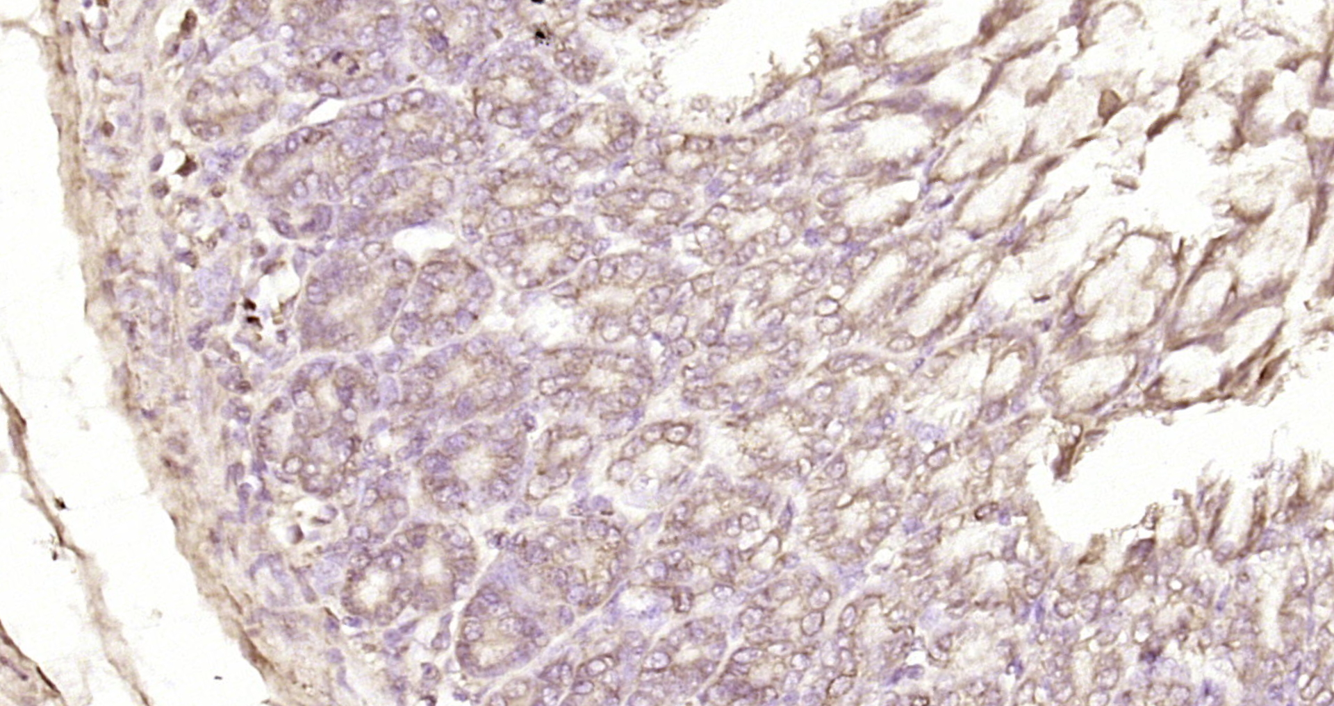 Paraformaldehyde-fixed, paraffin embedded Rat stomach; Antigen retrieval by boiling in sodium citrate buffer (pH6.0) for 15min; Block endogenous peroxidase by 3% hydrogen peroxide for 20 minutes; Blocking buffer (normal goat serum) at 37°C for 30min; Antibody incubation with PSF2 Polyclonal Antibody, Unconjugated (bs-7824R) at 1:200 overnight at 4°C, DAB staining. Paraformaldehyde-fixed, paraffin embedded Rat stomach; Antigen retrieval by boiling in sodium citrate buffer (pH6.0) for 15min; Block endogenous peroxidase by 3% hydrogen peroxide for 20 minutes; Blocking buffer (normal goat serum) at 37°C for 30min; Antibody incubation with PSF2 Polyclonal Antibody, Unconjugated (bs-7824R) at 1:200 overnight at 4°C, DAB staining.